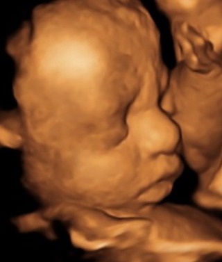 That little face…🥹
Seeing your baby during a scan is a moment parents never forget💫
Early reassurance scans from 8 weeks, gender scans from 16 weeks, and beautiful 4D scans from around 24 weeks🥰
📍 BabyScanUK - Nelson
👉 Appointments available online
#4DUltrasound #PrivateUltrasound #PrivateScan #Private4DScan #BabyScanUK