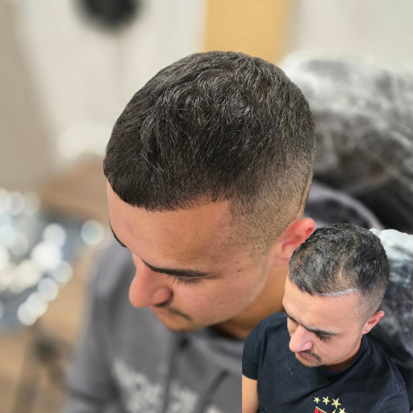 DENSITY
Density treatment added to the temples and worked through to the crown
Regarding longevity, my client has a strong hairline still but thinning from the top, so felt safe to do a density treatment as will fade over time before he ever needed to shave it
This was the second and final session
📍Bury St Edmunds
#smp #scalppigmentation #scalpmicropigmentation #hairregrowthtreatment #hairlosssolution #hairloss #hairtransformation #hairtransplantalternative #hairtattoo #scalptattoo