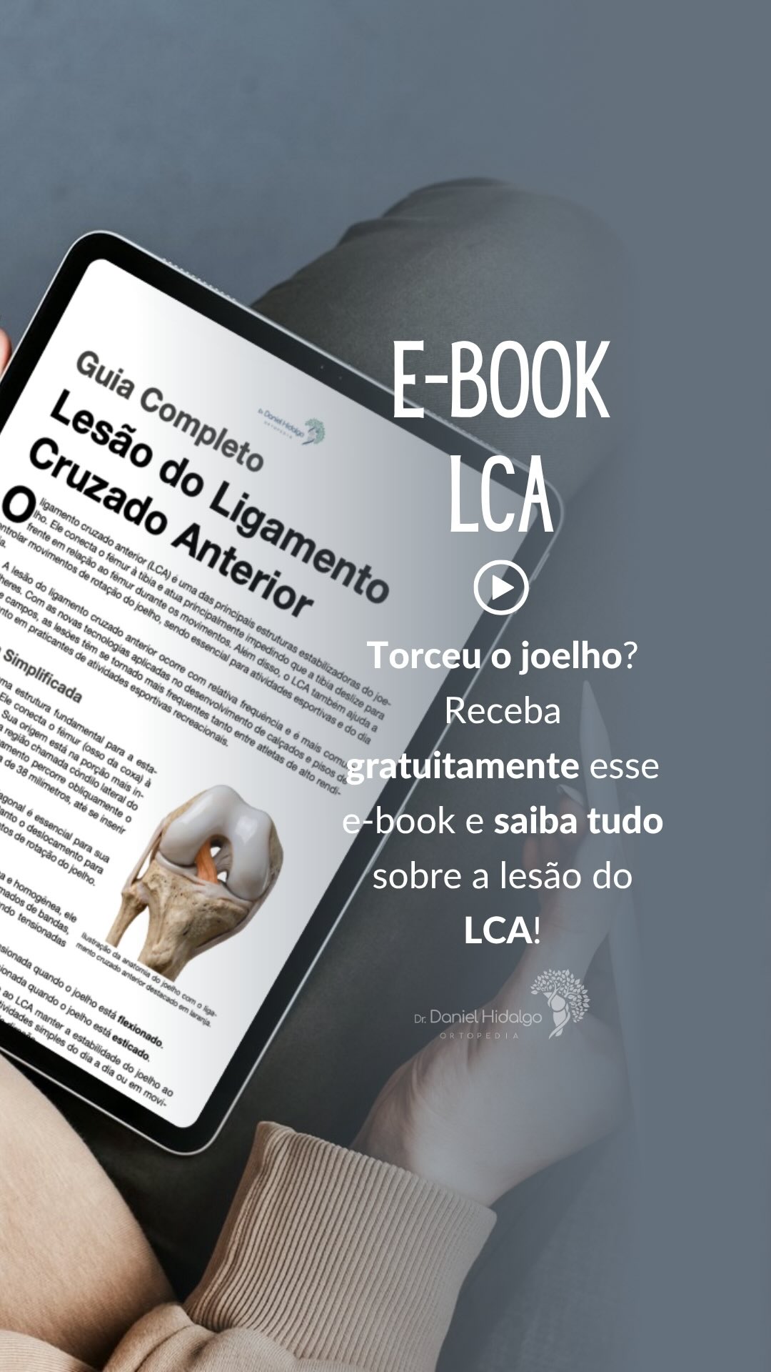 Você torceu o joelho e pode ter rompido o ligamento cruzado anterior? Ou conhece alguém que sofreu com esta lesão?🤔
A ruptura do LCA é uma das lesões mais comuns no joelho e também uma das mais mal compreendidas.
Pensando nisso, preparei um e-book completo, direto ao ponto, para te ajudar a entender:�✔ O que é a lesão do LCA�✔ Quando operar (ou não)�✔ Como é a recuperação�✔ E como voltar ao esporte com segurança
Quer receber gratuitamente? 👇�
Comente “EU QUERO” que eu te envio o material no direct.
E marque aqui alguém que precisa entender melhor essa lesão! Isso pode fazer toda a diferença na recuperação! 💬👇
Dr. Daniel Hidalgo - Médico Ortopedista
CRM-SP 137.057 | RQE 41.112
Membro da Sociedade Brasileira de Ortopedia e Traumatologia (SBOT)
Membro da Sociedade Brasileira de Cirurgia do Joelho (SBCJ)
Membro da Sociedade Médica Brasileira de Tratamento por Ondas de Choque (SMBTOC)
#joelho #lca #ligamentocruzadoanterior #ebook