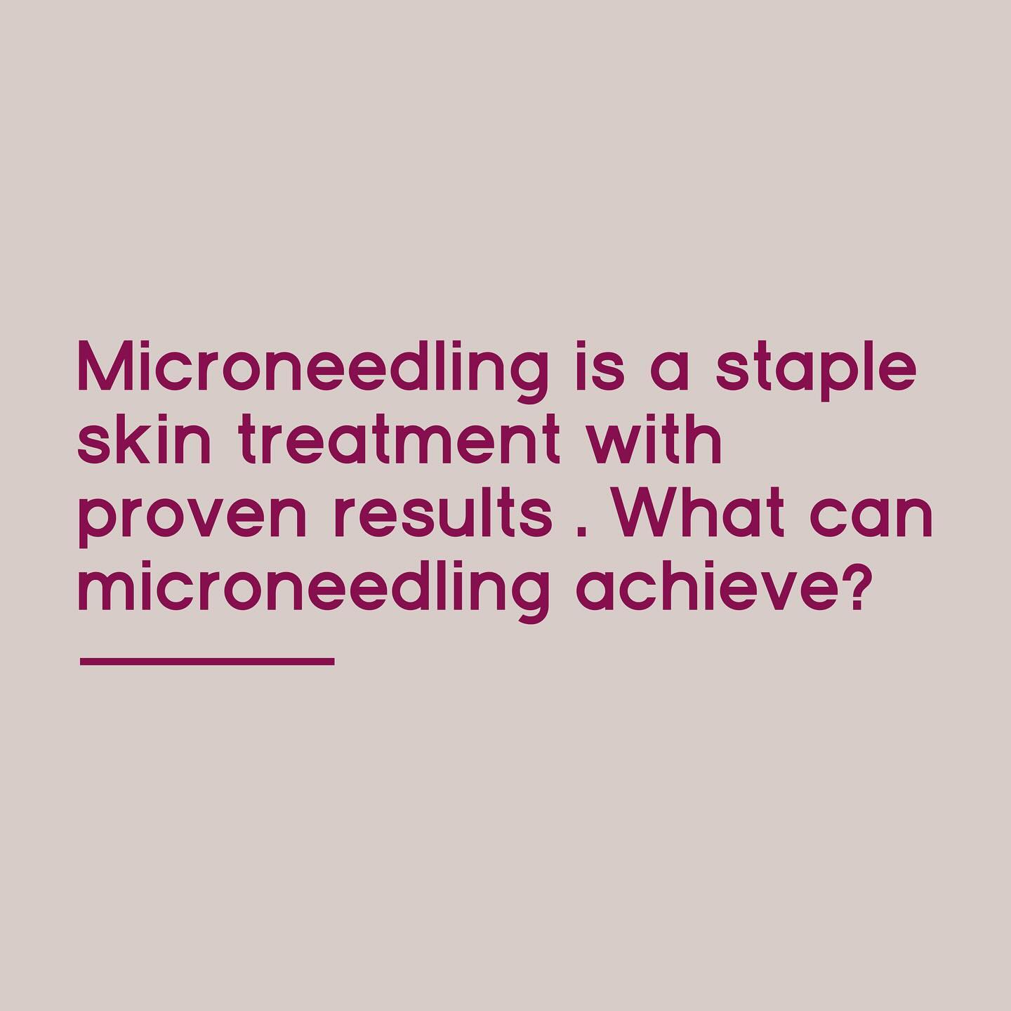 Let’s talk microneedling! A classic results driven approach to improve skin quality .
-#microneedling#microneedlingskinpen#acnescarstreatment#stretchmarkstreatment#betterskinleeds#leedsskinclinic
