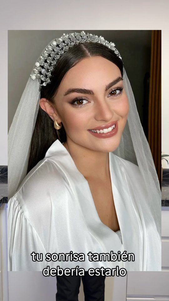 ¿Ya tienes todo lo que necesitas para tu boda ? La sonrisa no debe de faltar🦷✨, agenda tu cita📲 para poder alinearla y blanquearla para que ese dia estes reluciente
.
.
.
.
.
.
UANL Ced. Prof. 12948881
UANL Ced Maestria: 14532598
COFEPRIS: 2419032002A00440
.
.
.
#dentistamty #bodamonterrey
#odontologomty #sonrisaperfecta #bodamty