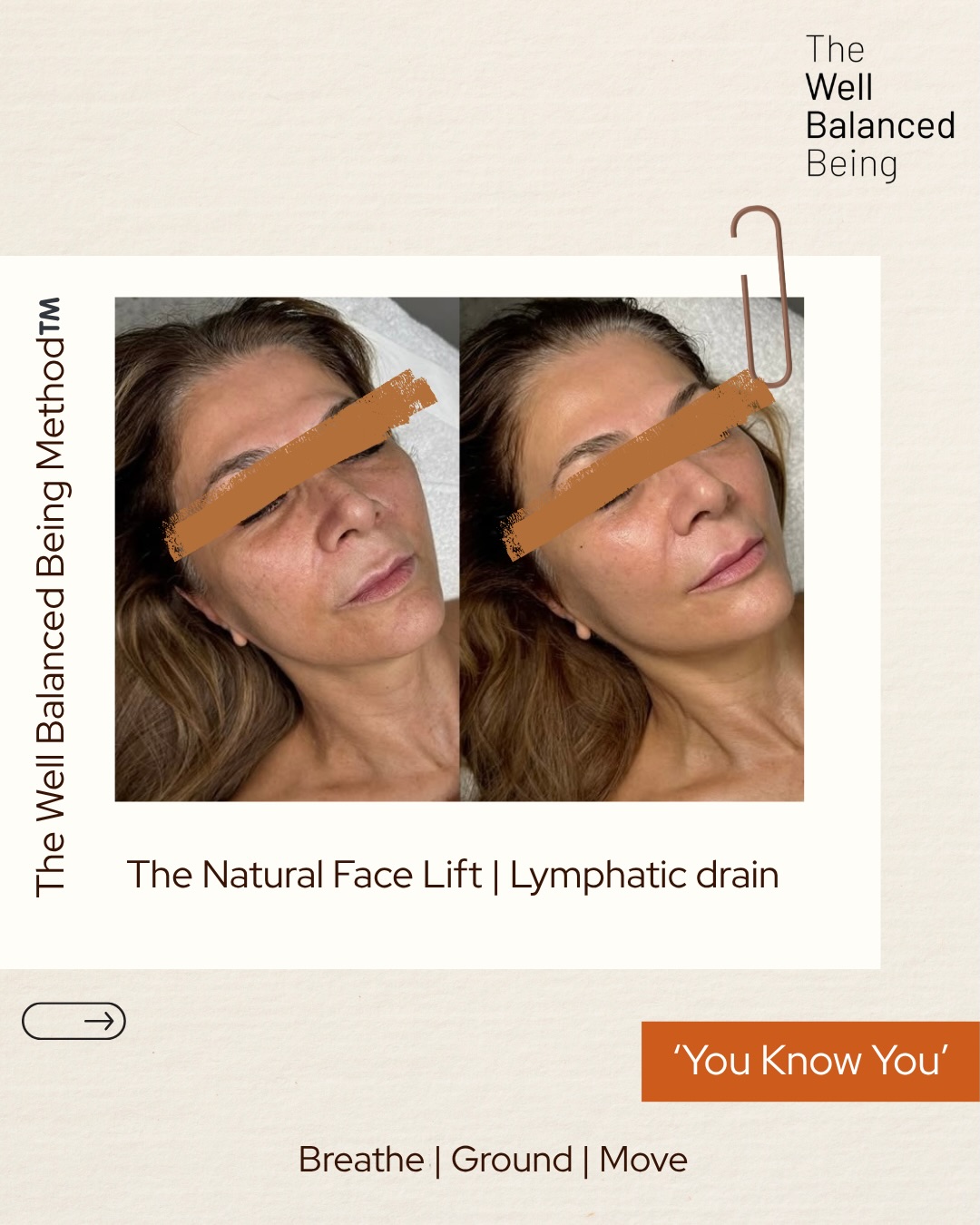 What has kept me busy this week...
Ladies Dayš«£šš§”š«¶š¼
Your natural liftā¦
And when we say Lymphatic drain, what we really mean TWBBMethodā¢ļø
Book your mixed modality approach, ready for YOUR next event.
š§”Weddings.
š§”Race days.
š§”Birthdays.
š§”Special occasions where you want to feel like you, just more lifted, rested & radiant.
This isnāt a quick fix.
And itās not about forcing the face.
Itās about releasing the tension thatās been holding it down.
Because before an event, your face is often carrying:
⢠Stress from busy schedules
⢠Jaw and neck tension
⢠Poor sleep or nervous system overload
⢠Fluid retention and dullness
The Well Balanced Being Methodā¢ļø prepares your face differently.
Through:
⢠Targeted facial & TMJ release
⢠Myofascial and lifting techniques
⢠Acupressure & craniosacral principles
⢠Nervous system regulation
We support your face to:
soften, sculpt and naturally lift | without force.
So you donāt just look betterā¦
you feel calmer, clearer and more like yourself.
You will notice:
⢠A more lifted, defined jawline and cheek area
⢠Brighter, more radiant skin
⢠Reduced puffiness and tension
⢠A relaxed, confident presence (that shows)
Because the best glowā¦
comes from a body that feels safe and balanced.
Perfect as part of your event preparation.
Book your TWBB Methodā¢ļø Facial
Release ideally 1 week and again, 1 day before your event for best results.
DM or book via link in bio.