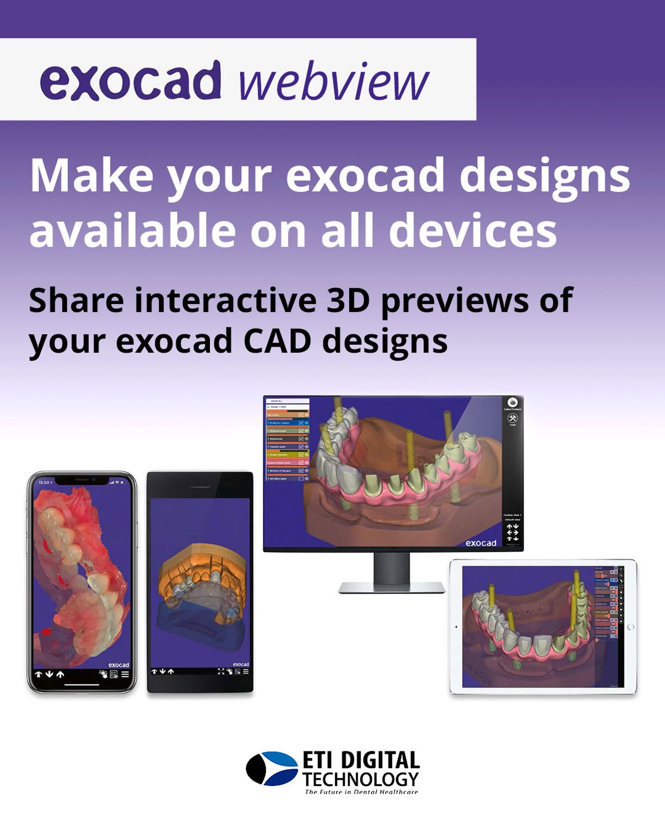✅ exocad DentalCAD 3.3 Chemnitz is the leading and most easy-to-use dental CAD Software that offers an intuitive design workflow, plus the freedom to save time with more than 45 new features and over 85 enhanced features! This is the ultimateCAD design solution for your dental laboratory or clinical office.
.
📚 For more information on exocad DentalCAD 3.3 Chemnitz or our digital offering, please ☎️ contact ETI Digital Technology today at 📞 714-238-1490 or 📧 sales@etidigitaltechnology.com
#exocad #exocaddentalcad #dentaldesignsoftware #ETIDigitalTechnology #DentalLaboratory