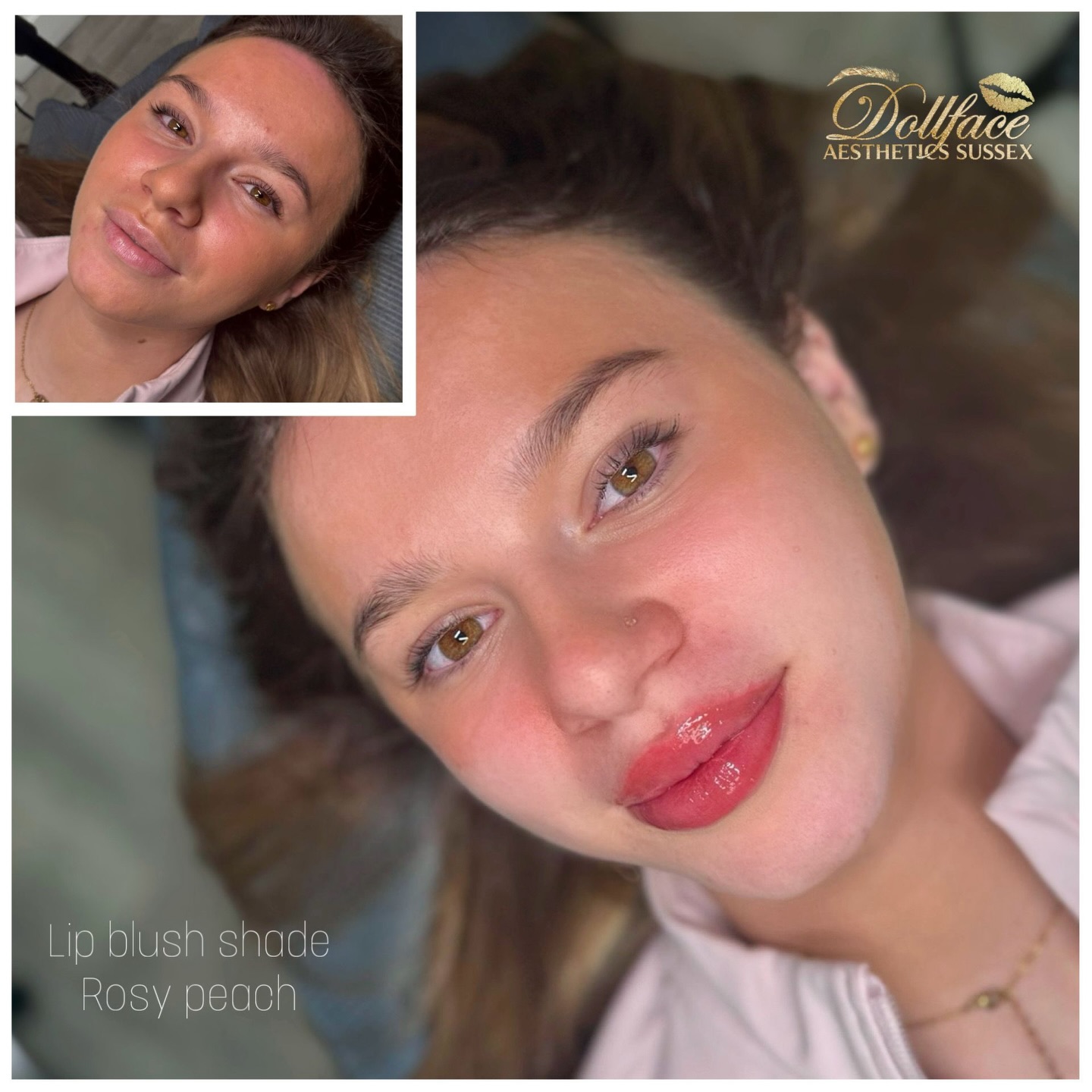 Lip blush is more than just a beauty treatment — it’s a confidence boost, a time-saver, and a way to enhance your natural features effortlessly.
This semi-permanent treatment works by softly depositing pigment into the lips to improve colour, shape, and definition. Whether you want to restore lost colour, neutralise uneven tones, or simply wake up with a fresh, tinted look every day, lip blush can be completely tailored to you.
✨ Benefits of lip blush:
• Enhances your natural lip colour
• Creates the illusion of fuller, more defined lips
• Corrects uneven tone or pigmentation
• Saves time on daily makeup routines
• Long-lasting results (typically 1–3 years with top-ups)
The healed result is soft, natural, and beautifully subtle — not heavy or overdone. Think “your lips but better.”
💉 What to expect:
A personalised consultation to choose your perfect shade, followed by a gentle procedure using precise techniques. Healing takes around 7–10 days, with full results settling over a few weeks.
💖 Perfect for:
Anyone wanting a low-maintenance beauty routine, a confidence boost, or a fresh, youthful look without fillers.
#LipBlush #SemiPermanentMakeup #NaturalBeauty #WakeUpWithMakeup LipTint BeautyTreatment ConfidenceBoost PMUArtist