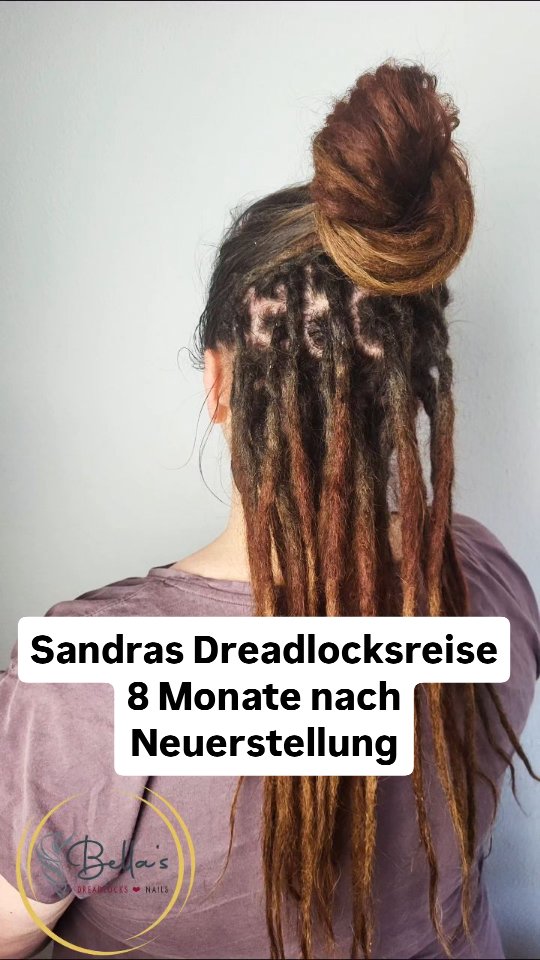 Bellas Dreadlocks-Wörgl
#partialdreadlocks #dreadstylistin #dreadhead
#dreadlockstirol #dreadlockswoergl