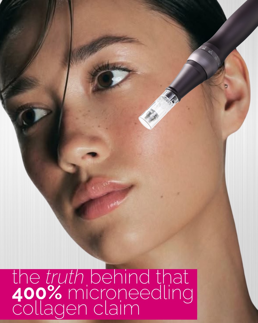 Let’s clarify one of the most repeated microneedling claims: “does microneedling give you 400% more collagen?”
The number comes from research looking at collagen and elastin changes in treated skin after a series of microneedling sessions, not one treatment, and certainly not a guaranteed visual result for every patient.
Microneedling works by creating controlled micro-injuries that stimulate your skin’s natural wound-healing response. Over time, this can support collagen remodeling, skin texture, firmness, acne scarring, and overall skin quality.
At Skin Worthy, we believe in results but we also believe in accurate education. Microneedling can absolutely boost your collagen by 400%, it just needs context (and of course the right provider & plan).