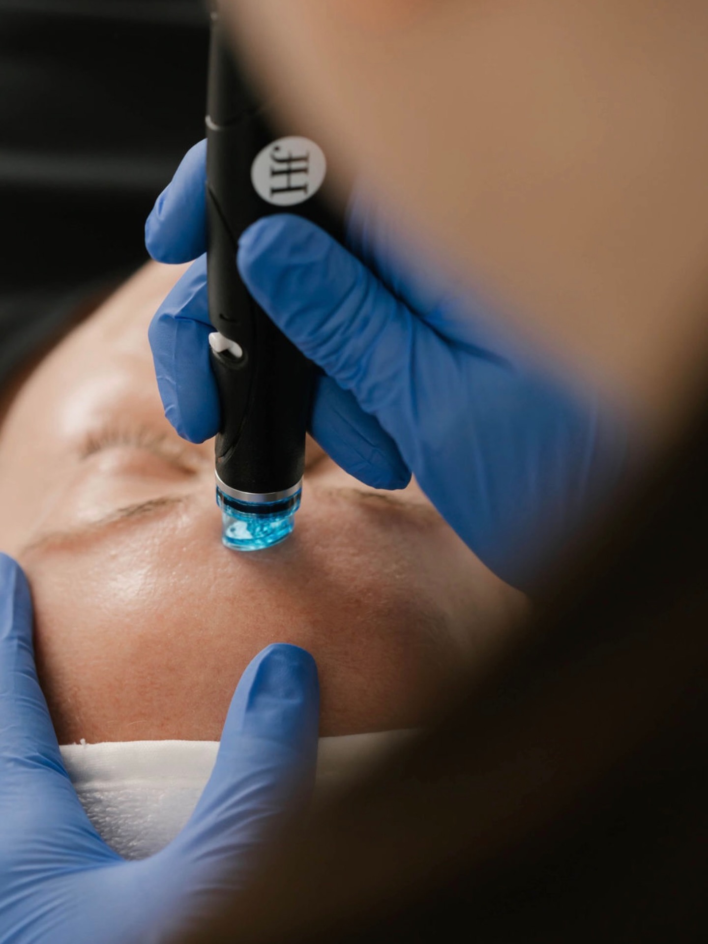 At View Laser, our HydraFacial goes beyond the basics with the added benefits of red light therapy.
This multi-step treatment deeply cleanses, exfoliates, and hydrates the skin while infusing targeted serums, leaving you instantly refreshed, plump, and radiant 💧
Paired with red light therapy, it also helps to:
- Support collagen production
- Calm inflammation + redness
- Improve overall skin tone and texture
The result? Healthy, glowing skin that looks as good as it feels, with no downtime.
Available in clinic now
📞 Call 604-943-9399
📧 reception@viewlaser.com