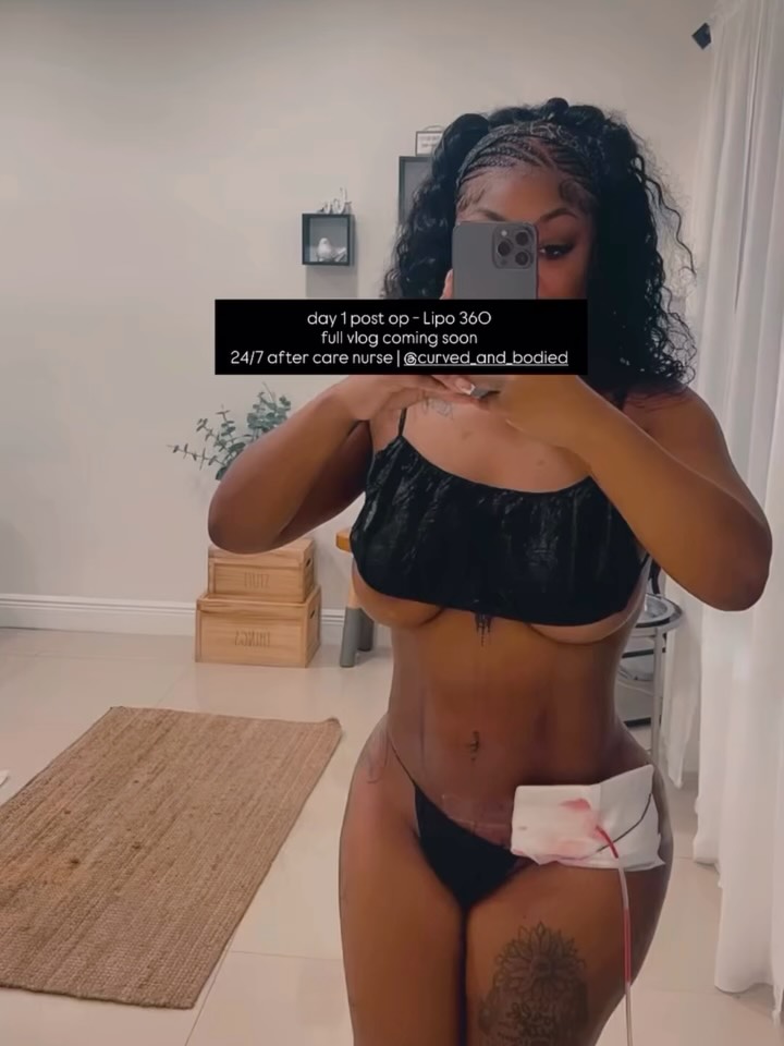 Your healing deserves privacy, luxury, and expert hands 💉✨
Our Post-Op Private Care is designed to give you a safe, smooth, and stress-free recovery in the comfort of your space.
Because after surgery… you should only focus on healing 🤍
ITS SNATCH SZN BOOK-NOW!
#postopcare #viral #postoprecovery #bbljourney #lipo