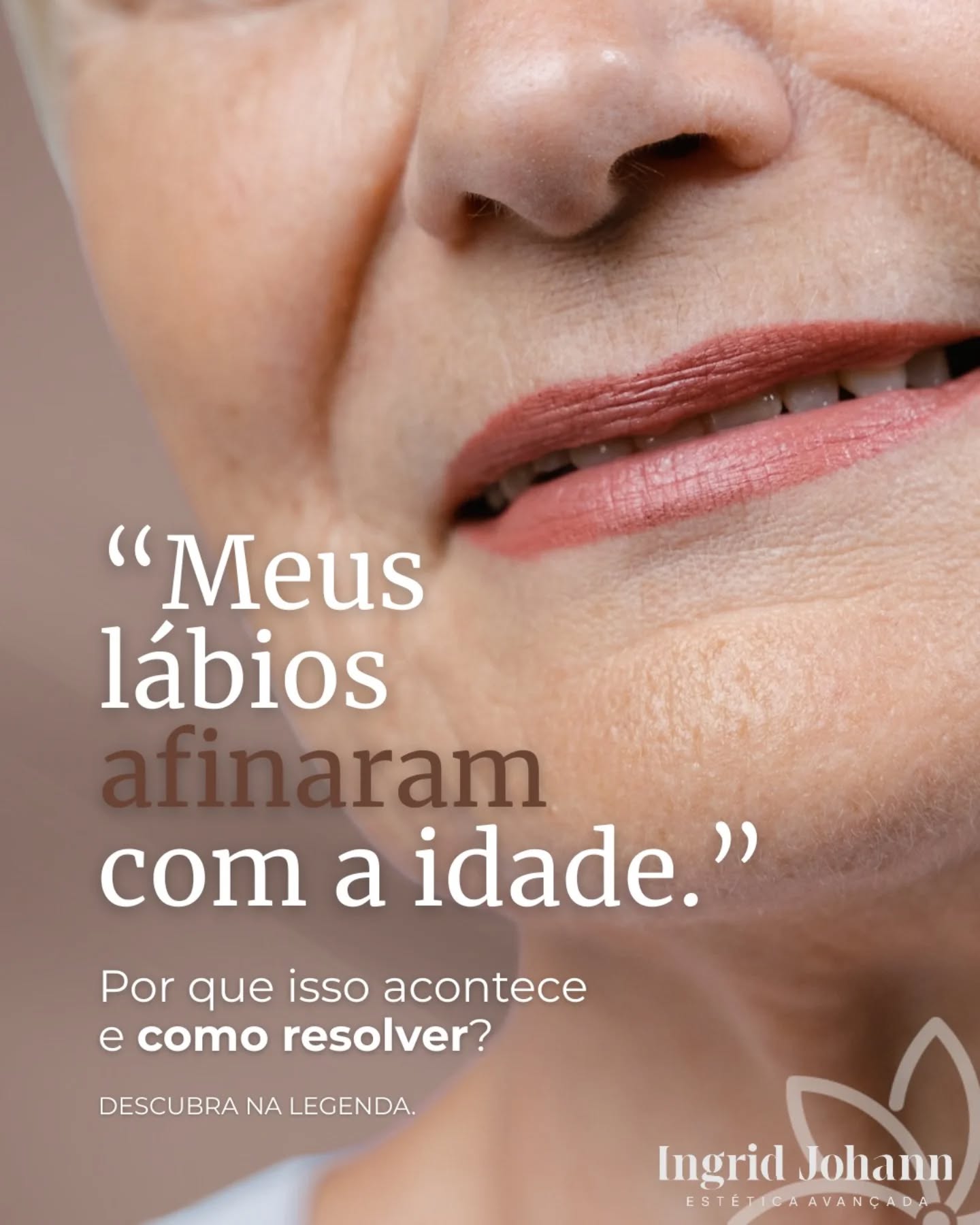 “Meus lábios afinaram com a idade…”
Sim, isso é normal — e tem explicação.
Com o passar dos anos acontece:
• Perda de colágeno
• Reabsorção óssea
• Diminuição do volume natural
• Alongamento do lábio superior
• Perda de contorno e definição
O resultado é um lábio mais fino, menos projetado e com aspecto envelhecido.
A boa notícia?
É possível restaurar estrutura, contorno e volume de forma natural e proporcional ao seu rosto.
Preenchimento labial não é sobre exagero.
É sobre devolver o que o tempo levou, com técnica e equilíbrio.
📍 Agende sua avaliação e descubra o que é indicado para você.
#preenchimentolabial #lábiosnaturais #harmonizaçãofacial #envelhecimentofacial #contornolabial