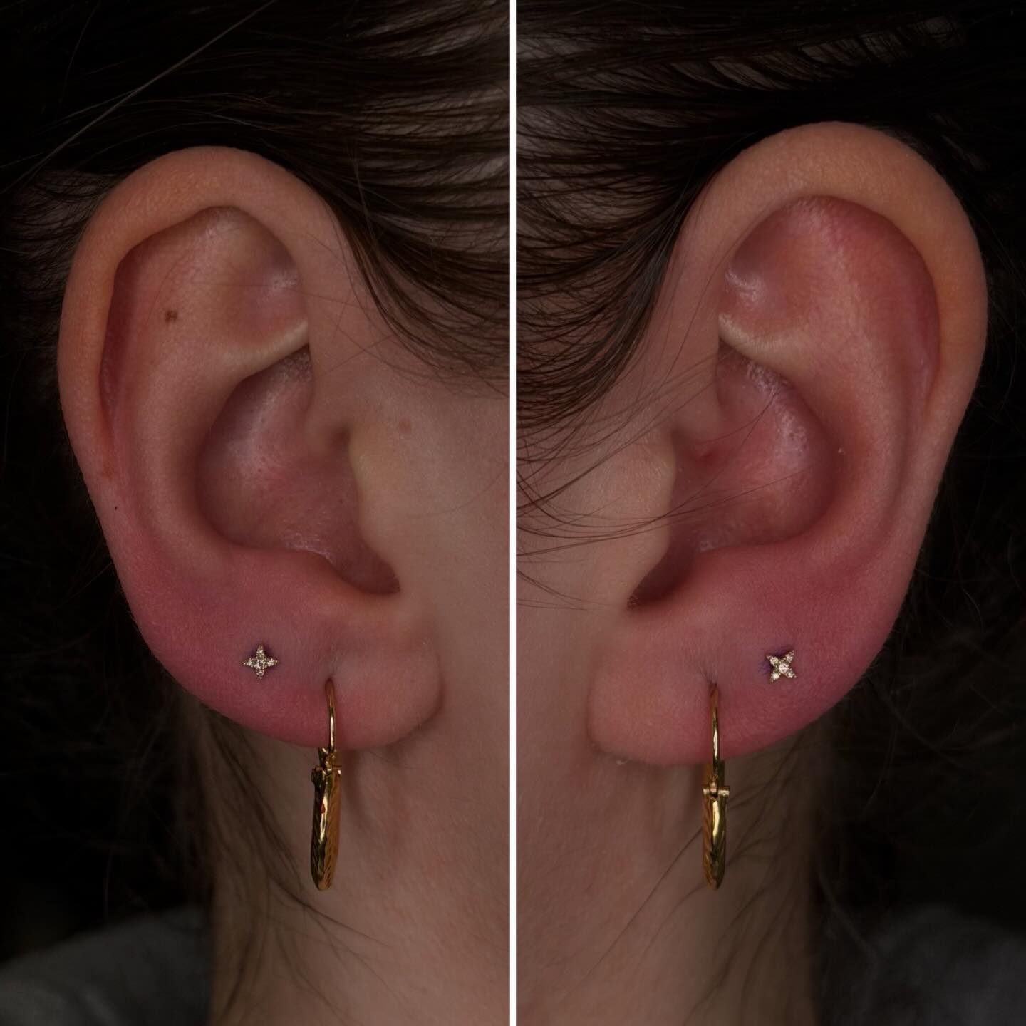 Second Lobe Piercings!
Simple & Sweet ✨
@piercingbyroy ✨
#staytruebodypiercing
#safepiercing
#appmember
