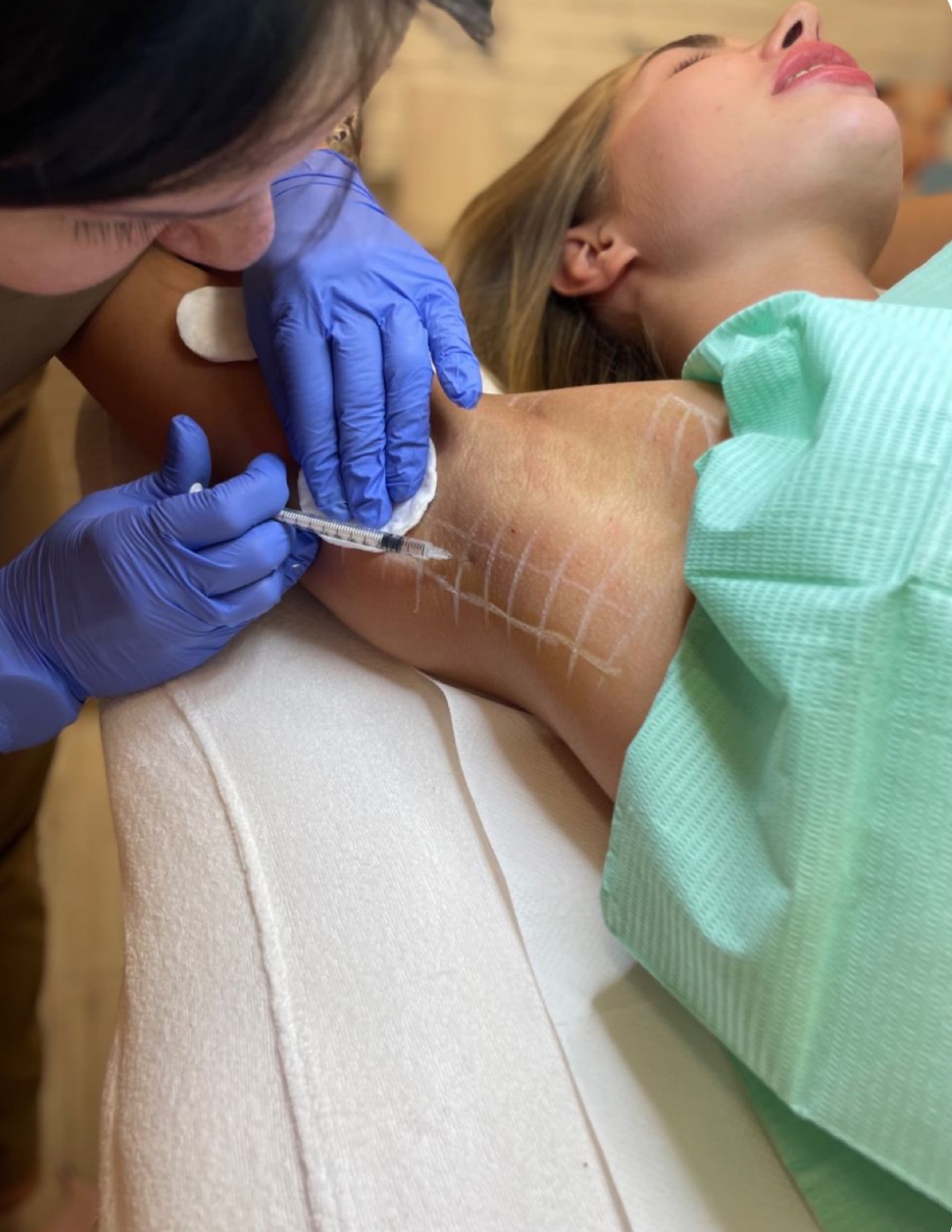 Summer is coming… no more underarm sweating
Excessive sweating can affect confidence, especially in warmer months — but it doesn’t have to.
At Priory Medical, we offer underarm treatments using botulinum toxin to reduce sweating safely and effectively.
✔ Noticeable reduction in sweating within days
✔ Results last up to 6 months
✔ Quick, in-clinic procedure
✔ No downtime
Feel confident in every outfit this summer.
Underarm sweating treatment – from €350
Message us to book your appointment.
https://www.prioryclinic.ie/book-online. #botoxdublin #botoxathlone
