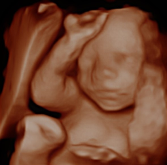 Little face, tiny features…and already so much personality🥹🤍
4D scans give you the chance to see your baby in a whole new way - capturing those precious little details before they arrive✨
4D scans available from around 26+ weeks🤍
📍 BabyScanUK - Nelson Scan Clinic
👉 Book your scan via our website
#BabyScanUK #4DUltrasound #PrivateUltrasound #PrivateScanClinic #4DScan