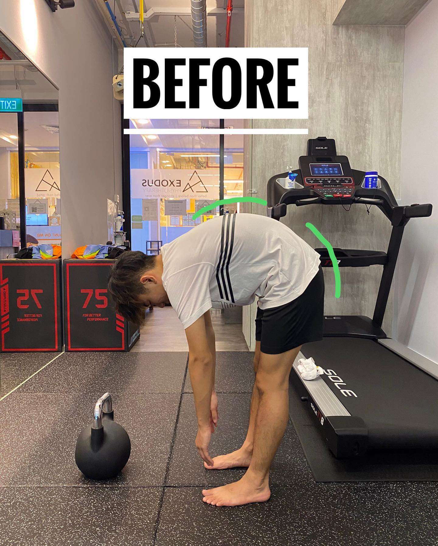 No manual therapy involved. Just a few minutes of good old movement correction and voilà, the bending movement is restored.
Poor lumbopelvic control can often lead to different kind of injuries in the back, hips, and legs. In this case, our patient had a bad hamstring tear a few weeks back while playing floorball.
A simple movement correction like this can go a long way in helping him be #betterthanbefore!
#exodusphysio #sgphysio #physiosg #strongerthanever #hougangphysio