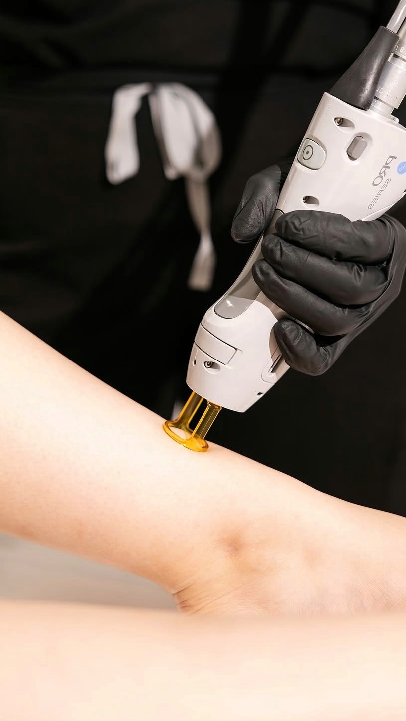 Say goodbye to shaving, waxing, and ingrowns 👋✨
We’re so excited to introduce laser hair removal… featuring the industry gold standard: the Candela GentleMax Pro. This state-of-the-art, medical-grade technology uses dual wavelengths to safely and effectively treat all skin types while targeting the hair follicle for long-term reduction
Think smoother skin, fewer appointments over time, and a treatment that’s faster, more comfortable, and incredibly effective thanks to advanced cooling technology and precision targeting
Whether you’re ready to ditch your razor or just simplify your routine, this is your sign 💫
Ready to start your journey to silky, low-maintenance skin?
Tap the link in our bio or book here: https://www.remedywichita.com/services/laser-hair-removal
#RemedySpa #LaserHairRemoval #WichitaSpa #SmoothSkin #CandelaGentleMaxPro