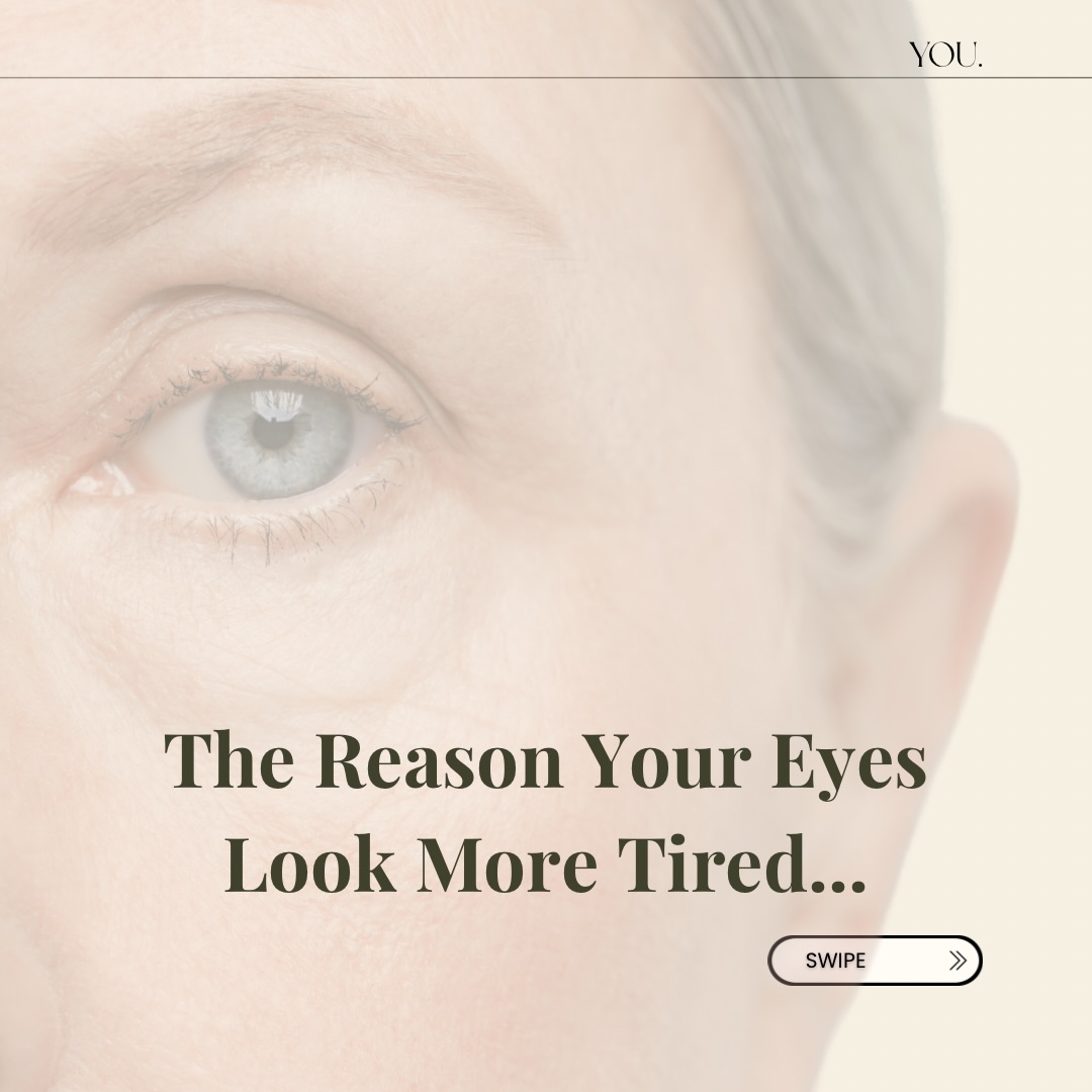 It’s not just “dark circles.”
It’s structural change.
That’s why nothing seems to fix it.
📩 DM “EYES”
📧 hello@lifestyleyou.co.uk
📱 WhatsApp: 07843 841144
#tiredeyes #undereyeconcern #aestheticclinicuk #skinresults #advancedaesthetics