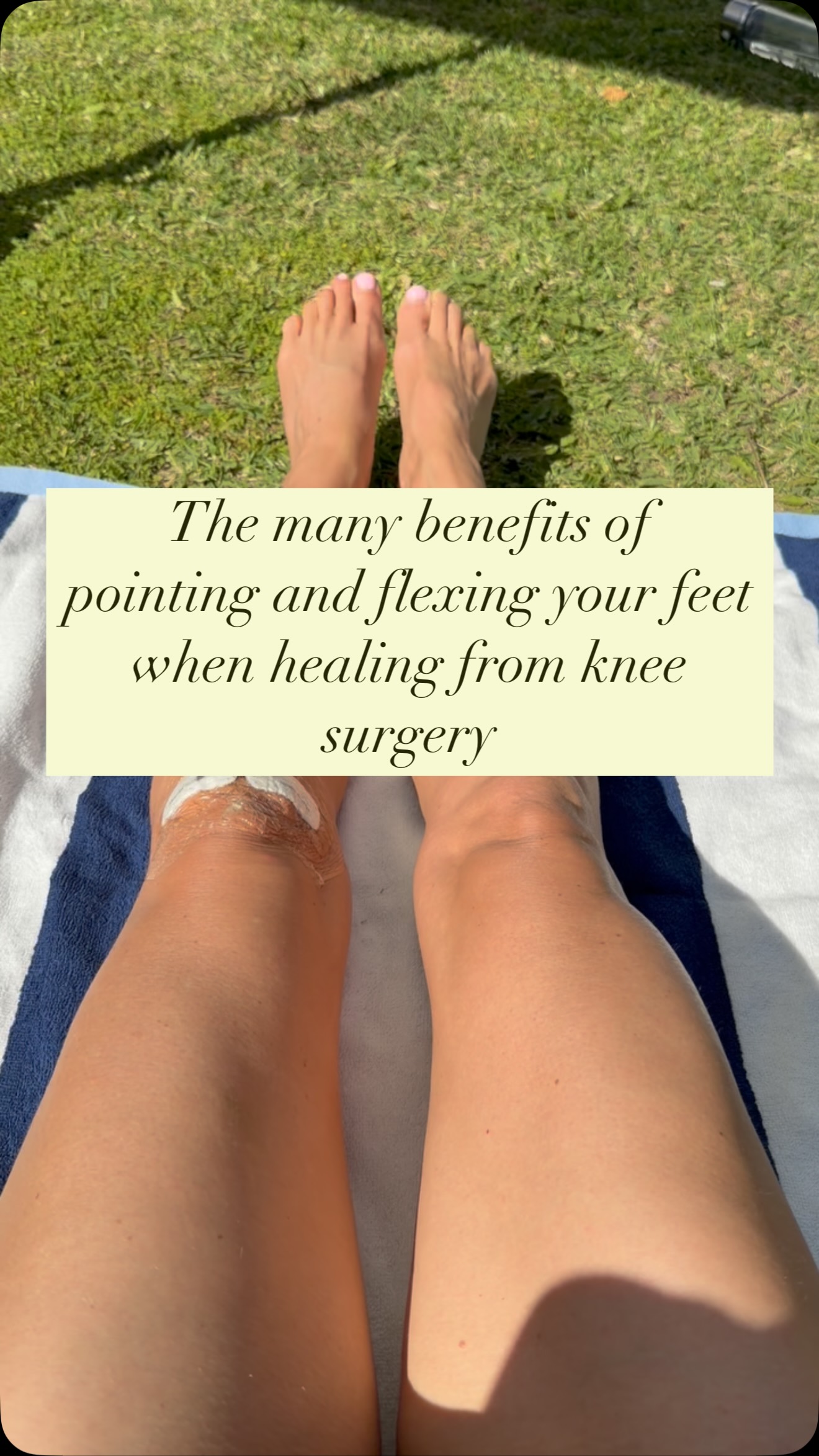 Been doing this simple action of pointing and flexing the feet (also known as ankle pumps), it has so many benefits when you are mostly resting and trying to heal.
I have 3 blood clotting gene mutations which means I am more prone to blood clots after surgery. This exercise done regularly means I can keep the blood flowing and avoid a DVT.
Other benefits are…
- maintaining muscle activity to prevent stiffness in the lower leg
- improved circulation of blood means better healing
- reduced postoperative swelling as the pumping action helps move fluid out of the knee joint and lower leg
Fun fact… the calf muscle is often referred to as the second heart. Pumping the feet back and forth causes calf muscles to contract and squeeze deep veins, pushing deoxygenated blood upward toward the heart against the pull of gravity, thereby assisting in cardiovascular health.
I have always done my ankle pumps when seated for any length of time (particularly when flying or long drives) to help my blood move. I say add them into your day especially if you have to sit at a desk for work!
-
-
-
#integrativehealth #wellness #health #integrativewellness #healthyhabits #healthyliving #healthylifestyle #naturalhealth #healthyhabits #healingthemeniscus