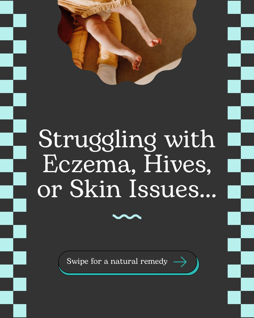 Your kid's eczema isn't a skin problem. It's an inflammation problem. 🌿
ㅤ
If you're stuck in the steroid cream cycle - flare-up, treat, temporary relief, repeat - you're not alone. And you're not crazy for thinking there has to be a better way.
ㅤ
Eczema and hives are your child's body pushing internal inflammation OUT through the skin.
But where does that inflammation come from?
The nervous system.
ㅤ
When your child's nervous system is dysregulated, it triggers chronic inflammation, histamine overproduction, immune hyperactivity, and gut issues...and all of that shows up on the skin.
ㅤ
Your nervous system controls your gut.
Your gut controls 70% of your immune system.
Your immune system controls inflammation.
ㅤ
When there's spinal interference (especially mid-back), the nerves controlling gut and immune function can't communicate properly. That's when you see chronic skin issues that won't resolve no matter what cream you use.
ㅤ
Chiropractic care removes that interference, regulates the nervous system, and allows the body to calm inflammation from the inside out.
ㅤ
Swipe through to learn why eczema is a nervous system problem 👉 and drop 🌿 if this is your child's struggle.
ㅤ
You don't have to accept constant flare-ups as normal. 💚