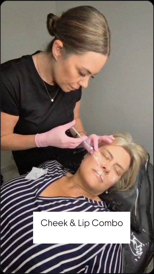 Enhancing natural features, not changing them 🤍
This treatment focuses on restoring volume, refining shape and creating balance across the face — using precise placement and a tailored approach for each client.
Cheek & lip filler can:
– Add structure and lift
– Restore lost volume
– Enhance natural symmetry
– Create a softer, more youthful profile
Every face is different, which is why no two treatments are ever the same.
📍Basildon
📲 Book via the link in bio
#EssexBeautyAndAesthetics #essexfillers #EssexAesthetics #basildonbeautytreatments #basildonaesthetics