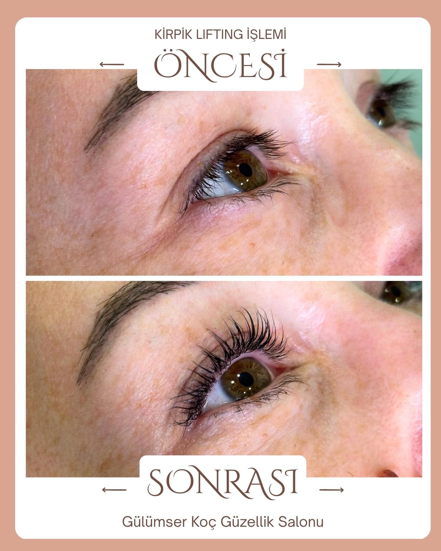 Kirpik Lifting işlemimiz Öncesi ve Sonrası ⭐️👏🏻
Sen de kusursuz kirpiklere kavuşmak istiyorsan bizimle iletişime geçebilirsin ✅
Gülümser Koç Güzellik Salonu
0850 346 0 436