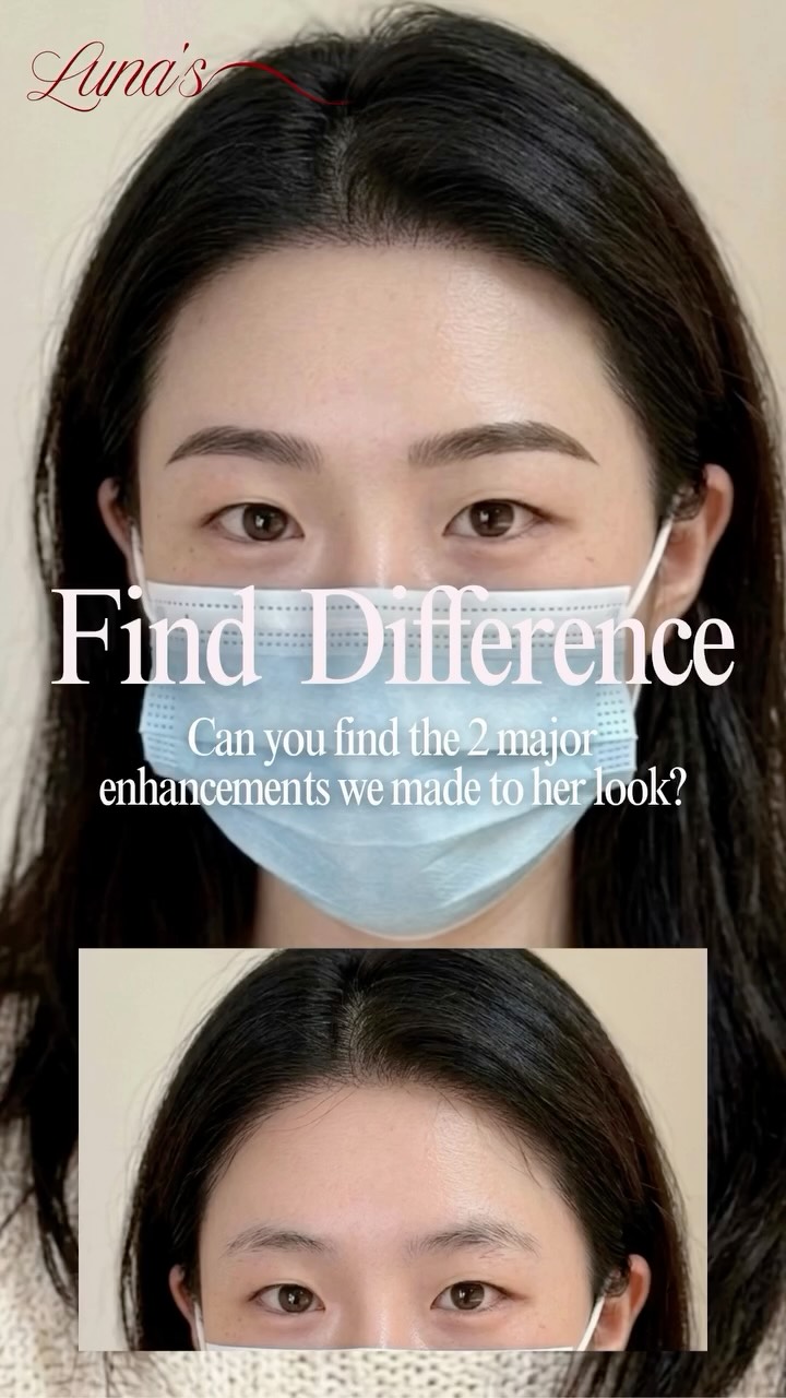 She didn’t need a different face. She needed her hairline back.
You know that feeling when your forehead looks a little too “open” in photos…
when your brows are done, your skin is glowing, but something still feels off?
For a lot of women, it’s not their features.
It’s the hairline framing the face.
A sparse, uneven hairline can make the whole face feel less balanced — even when everything else looks fine.
And no, the goal isn’t to make it look harsh, blocky, or obviously tattooed.
The goal is this:
• soft structure
• natural density
• a more balanced frame around your face
That’s exactly why I created this Hybrid Hairline result.
It’s designed to:
• fill in sparse areas softly
• create the illusion of fuller density
• improve facial balance without looking heavy
• blend advanced shading + hair stroke detail for a more natural finish
This is for you if:
• your hairline looks thin in photos
• you’re tired of using powder or makeup to fill it in
• you want a more polished look with less daily effort
• you want subtle enhancement, not something obvious
The best part?
You wake up already looking more framed, more balanced, and more put together — without adding another step to your routine.
Hybrid Hairline will be available to book starting in May.
If you want early info before spots open:
DM “HAIRLINE” to ask questions + join the waitlist.
#HairlineTattoo #HybridHairline #ScalpEnhancement #RichmondHillBeauty #RichmondHillPMU