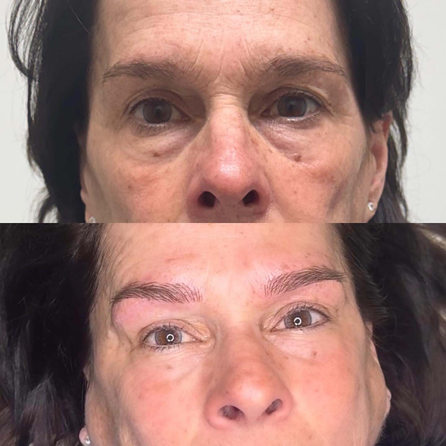✨𝗡𝗮𝗻𝗼 𝗠𝗮𝗰𝗵𝗶𝗻𝗲 𝗛𝗮𝗶𝗿𝘀𝘁𝗿𝗼𝗸𝗲𝘀✨ is an advanced cosmetic tattoo hair stroke technique that is achieved through the use of a digital machine and an ultra-fine liner needle. This soft and minimally invasive method enables a dimensional application of realistic hair-like strokes that seamlessly replicate the appearance of natural brow hairs.
Nano strokes are suitable for all skin types and are known for their soft, hyper-realistic results that heal beautifully over time.
Pain level: Minimal (numbing is used throughout the procedure)
Healing time: Approximately 7 days
Longevity: Approximately 1.5–2 years, depending on skin type and lifestyle, before a touch-up is recommended
Inquiries + Bookings:
📩 DM for more information
🔗 Booking link in bio
𝙇𝙖𝙫𝙖𝙡 & 𝙈𝙤𝙣𝙩𝙧𝙚𝙖𝙡 𝙉𝙖𝙣𝙤 𝘽𝙧𝙤𝙬𝙨 / 𝘾𝙤𝙨𝙢𝙚𝙩𝙞𝙘 𝘽𝙧𝙤𝙬 𝙏𝙖𝙩𝙩𝙤𝙤 / 𝙋𝙚𝙧𝙢𝙖𝙣𝙚𝙣𝙩 𝙈𝙖𝙠𝙚𝙪𝙥
#NanoBrowsLaval
#NanoBrowsMontreal
#nanobrows
#browslaval
#permanentmakeuplaval