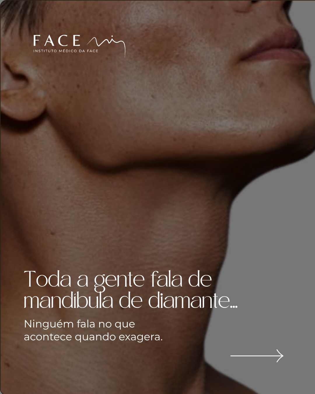 💎A mandibula de diamante virou trend, mas a que custo?
Na medicina estética, o objetivo nunca deve ser “mudar” a cara de alguém.
Deve ser melhorar, equilibrar e respeitar a identidade do paciente.
Uma mandíbula forte e com presença:
não chama atenção isoladamente,
não pesa no rosto,
e não faz as pessoas perguntarem “o que é que fizeste?”
Cada rosto exige um plano e não um padrão.
#mandibuladiamante #preenchimentomandibula #facemi #facemiporto
Os casos clínicos apresentados refletem o antes e depois de pacientes específicos. Cada pessoa é única e o resultado pode variar de paciente para paciente.
Todos os pacientes, antes de cada procedimento, passam por um processo de consulta médica de diagnóstico onde são avaliadas indicações, expectativas e motivações.
Registo ERS: 21236
Registo estabelecimento: E159774
Licença funcionamento: 21236/2022