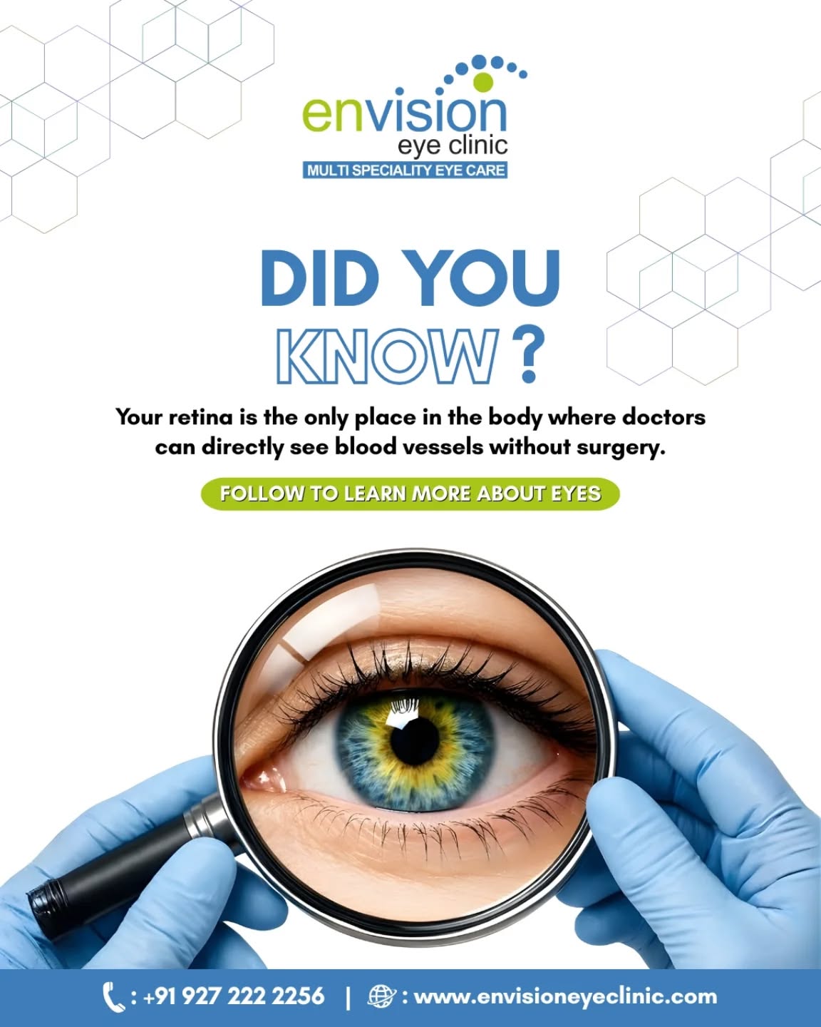 Did you know this about your eyes? 👁️🔍
The retina is the only place in your body where doctors can directly see blood vessels without surgery. That’s why eye exams can reveal not just vision issues, but overall health conditions too.
Regular eye check-ups can tell you more than you think.
📍 2nd Floor, Shivraj Apartments, near Parihar Chowk, Aundh, Pune, Maharashtra 411007
#DidYouKnow #EyeHealth #EnvisionEyeClinic #VisionCare #AundhPune