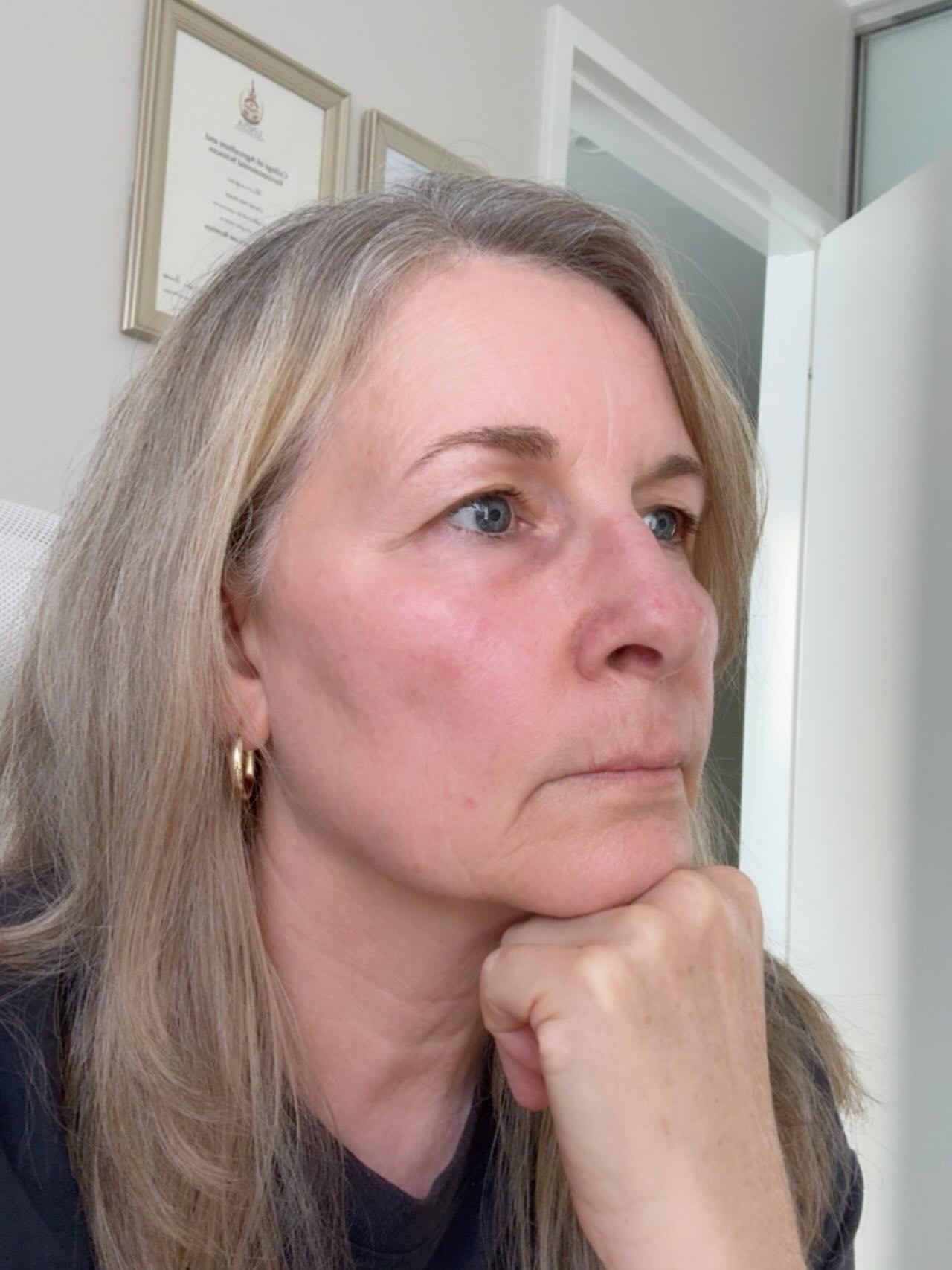 How you show up in love is how you lose yourself.
You don’t let people meet you fully.
You give them a version that feels acceptable.
And they fall in love with that.
Not you.
So over time, you feel unseen.
But they never met you to begin with.
Stop performing for acceptance.
It will cost you every time.
#authentic
#beyourself
#truelove