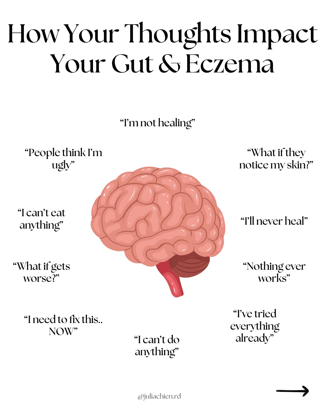 The connection between your mind, gut, and skin isn’t just “mindset”… it’s physiology.
When you experience chronic stress or repetitive negative thought patterns, you’re activating the HPA axis (hypothalamic pituitary adrenal axis).
The HPA axis is your body’s stress response system. This is where the brain communicates with adrenal glands to produce hormones like cortisol and adrenaline.
When stress becomes chronic, the HPA axis becomes constantly activated which over time, can lead to symptoms like indigestion, eczema flares, irritability, and other chronic symptoms.
Not only this, new research is now showing that stress activates immune cells on the skin, which can further exacerbate eczema symptoms (PMID 41855337)
But something to keep in mind 👇🏼
This isn’t about doing 10 mindfulness practices to “stop the stress.”
It’s about working on your body’s physiological response to stress.
Tools like through mental reframing, EFT, journalling, are really great for this but you have to find one that works best for you instead of doing it all!
If you want a free meditation to help regulate your nervous system, comment MEDITATION and i’ll send you the link! 💗
#gutbrainaxis #eczemahealing #chronicinflammation #mindbodyconnection #nervoussystemregulation