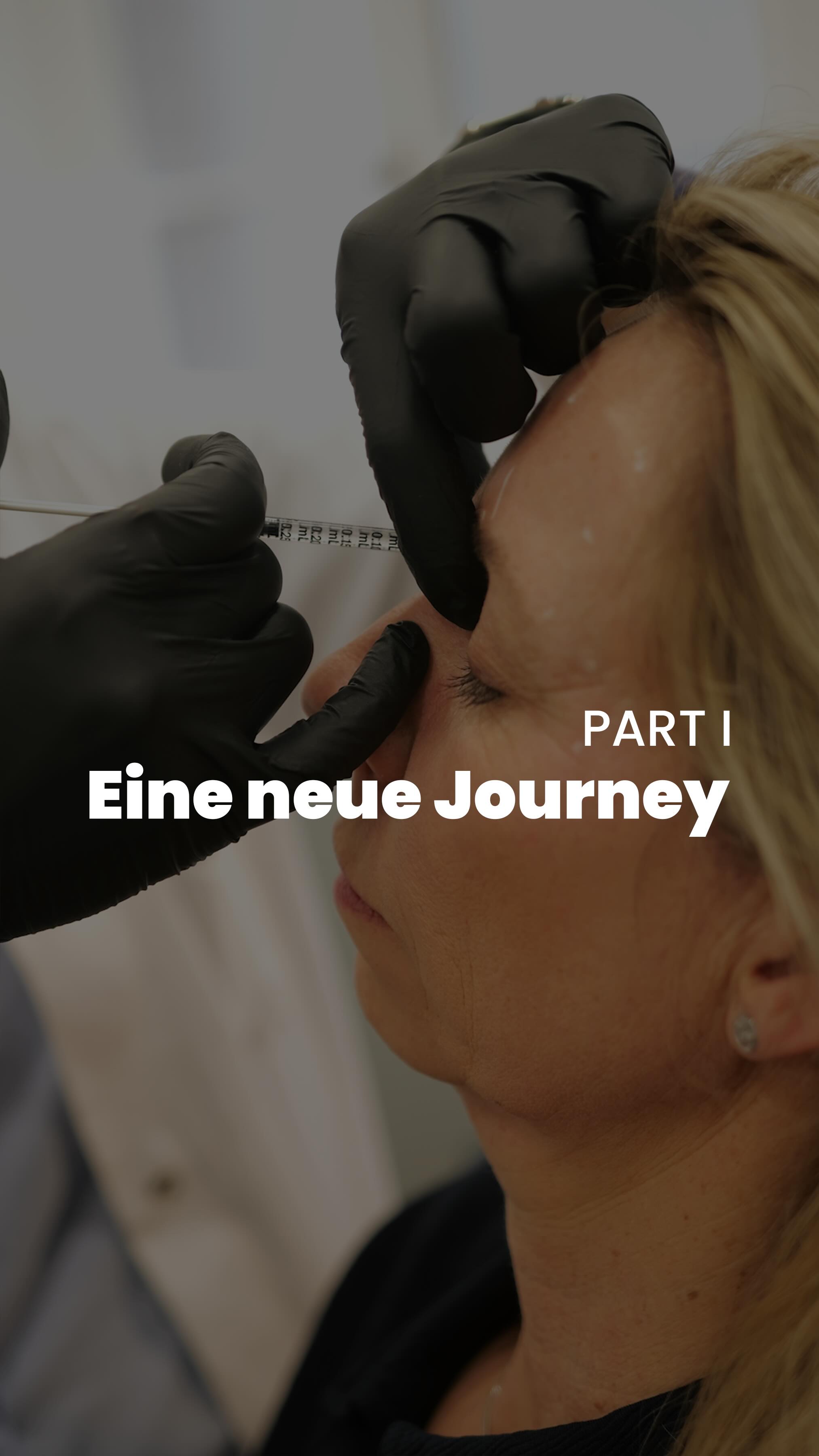 Eine neue Journey! ✨
Heute möchte ich euch eine neue Patientin vorstellen. Sie ist auf Empfehlung zu mir gekommen, worüber ich mich wirklich sehr freue. Empfehlungen sind für mich immer etwas Besonderes, denn sie zeigen, dass Vertrauen aufgebaut wurde und meine Arbeit geschätzt wird. Das bedeutet auch, dass ihr sie in den kommenden Beiträgen öfter begleiten werdet und wir Schritt für Schritt sehen könnt, wie sich ihr Gesicht verändert und harmonisiert.
Wir starten mit einer Botulinum-Behandlung, um die Falten im Gesicht gezielt zu bearbeiten. Dabei geht es nicht darum, die Mimik zu stoppen, sondern die Haut zu entspannen und die Gesichtszüge frischer wirken zu lassen. Jede Behandlung wird individuell geplant, um ein natürliches Ergebnis zu erzielen, das zu ihrem Gesicht und ihrer Ausstrahlung passt.
Was als Nächstes folgt, seht ihr dann in Part II. Ich freue mich, diese Journey mit euch zu teilen und zu zeigen, wie kleine, gezielte Maßnahmen große Wirkung entfalten können.
Eure Fachärztin Fr. Ludewig 😊
#neupatienten #journey #btx #beautydoctor #düsseldorf