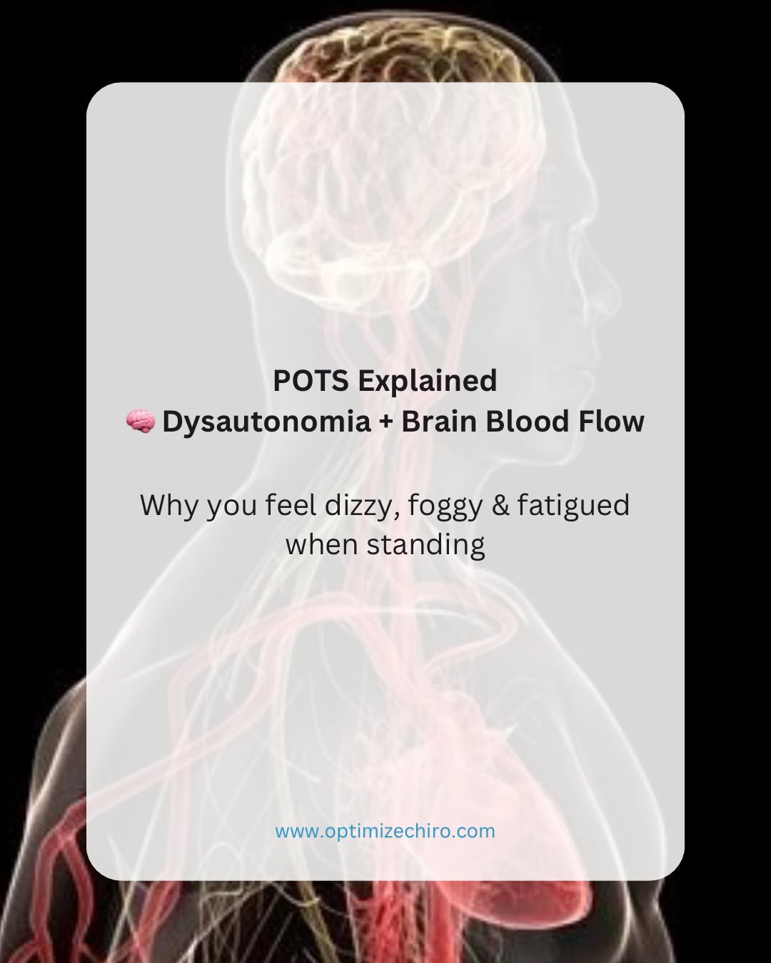 POTS isn’t just a heart rate issue — it’s a brain blood flow problem. 🧠
Postural Orthostatic Tachycardia Syndrome (POTS) is a form of dysautonomia, where the autonomic nervous system fails to properly regulate cardiovascular responses when you stand.
The result?
👉 Blood pools in the lower body
👉 Reduced venous return
👉 Compensatory increase in heart rate
👉 And in many cases… reduced cerebral blood flow
This phenomenon — cerebral hypoperfusion — helps explain why patients experience:
• Brain fog
• Dizziness
• Visual disturbances
• Fatigue
• Near syncope
Importantly, POTS is often triggered by real physiological events, including:
🦠 Viral illness (including COVID-19, EBV, influenza)
🧠 Concussion / traumatic brain injury
⚡ Autoimmune processes
💧 Hypovolemia
🧬 Connective tissue disorders
Diagnosis requires objective criteria, not just symptoms:
✔ ≥30 bpm HR increase within 10 minutes of standing
✔ Chronic symptoms (≥3 months)
✔ Absence of orthostatic hypotension
Testing (e.g., active stand / NASA lean or tilt table) is essential to confirm dysfunction and guide management.
💡 Clinically, POTS exists on a spectrum of autonomic dysfunction, often overlapping with:
• chronic fatigue syndromes
• post-concussion presentations
• vestibular disorders
📊 Key research insights:
• Many POTS patients demonstrate reduced cerebral blood flow when upright
• Up to ~50% may have small fiber neuropathy
• Strong links exist with post-viral and post-concussive states
• Increasing evidence supports neuroimmune involvement
🚨 If you experience persistent dizziness, fatigue, or brain fog — especially after illness or concussion — don’t ignore it.
It may be dysautonomia, not just deconditioning or anxiety.
#POTS #Dysautonomia #Concussion #BrainFog #Dizziness
