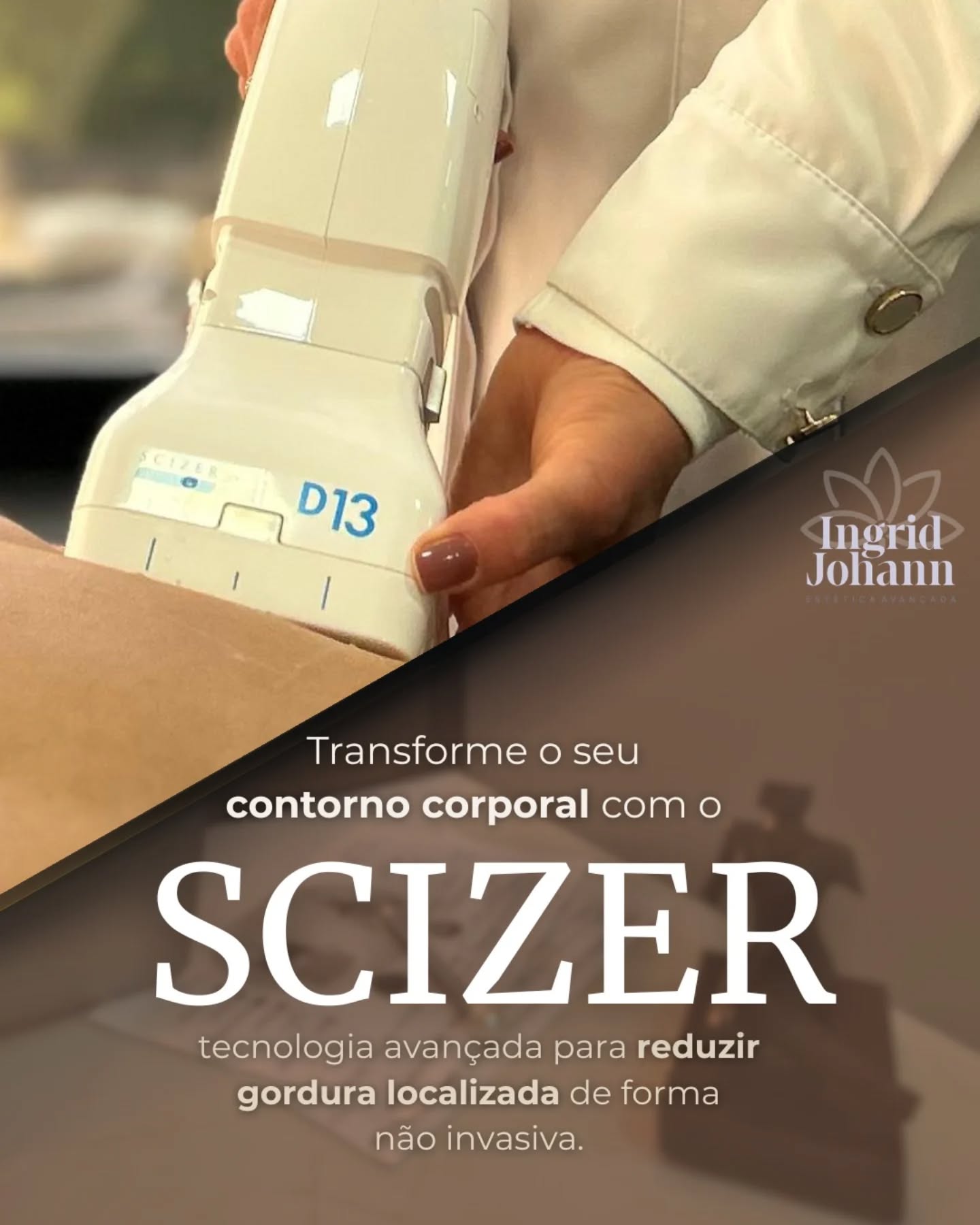 Transforme seu contorno corporal com tecnologia de alta performance
O SCIZER atua diretamente na gordura localizada de forma não invasiva, promovendo redução de medidas com conforto, segurança e precisão.
Sem cortes, sem tempo de recuperação, apenas resultados progressivos e naturais, respeitando a individualidade do seu corpo.
💡 Ideal para quem busca definição, melhora do contorno e mais confiança ao se olhar no espelho.
Porque o cuidado com o corpo também é sobre sentir-se bem em cada detalhe ✨
📲 Agende sua avaliação e descubra o protocolo ideal para você
#contornocorporal #estéticaavancada #gorduralocalizadanuncamais
#belezacomtecnologia #autocuidado❤️