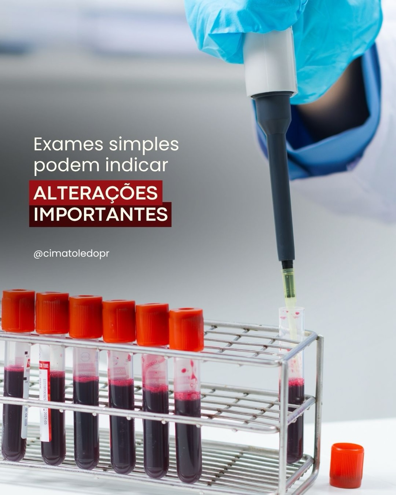 Um exame de sangue de rotina. Simples, rápido, acessível.
E ainda assim capaz de revelar alterações no colesterol, glicose, função renal, tireoide, marcadores inflamatórios antes que qualquer sintoma apareça.
A maioria das doenças crônicas não avisa quando começa. Elas avançam em silêncio enquanto a vida segue normal. É por isso que os exames laboratoriais de rotina não são burocracia médica são prevenção de verdade.
Saber o que está
acontecendo dentro do seu organismo é o primeiro passo pra cuidar dele com inteligência.
No CIMA, o laboratório faz parte de uma estrutura completa de saúde para que seus resultados sejam analisados com o contexto clínico que merecem.
🔗 Agende pelo link na bio.
#cima #cimapr #toledo #centrointegradodemedicinaavancada