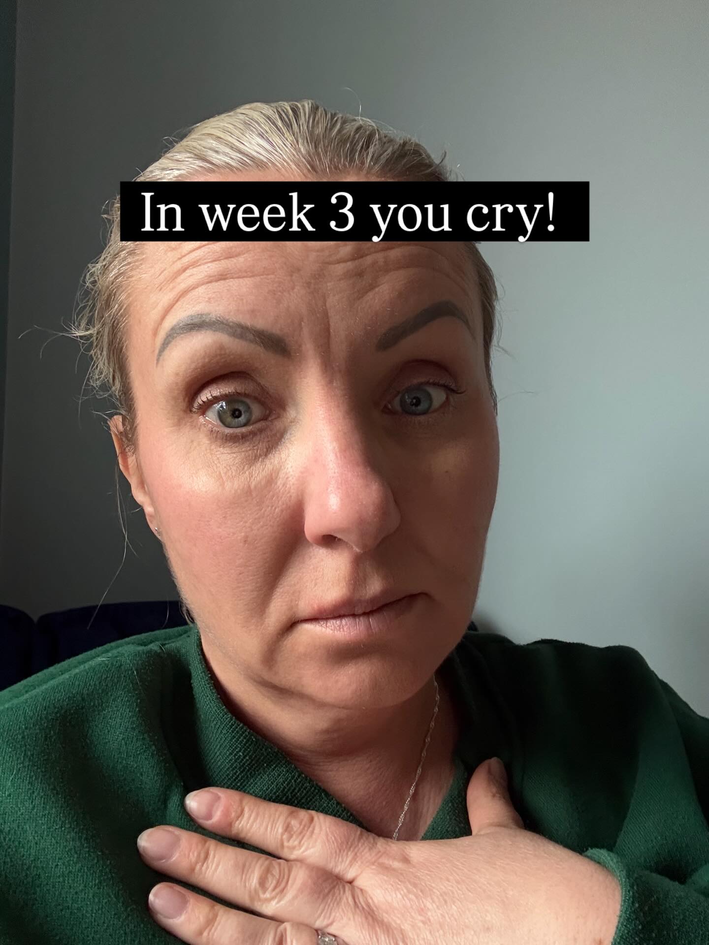 You cry in Week 3.
Not from pain. From relief. From the feeling of something that has been held for a very long time finally being set down.
You didn’t know how heavy it was until it wasn’t there any more.
The belief that your worth was conditional. That you had to look a certain way, earn a certain amount, be useful enough, good enough, chosen enough. That wanting more was greedy or naive or setting yourself up for a fall.
It was never the truth about you. It was what you learned. And in Week 3 your body finally understands the difference.
The weeks that follow feel quieter. Lighter. More like you.
You feel ready to live. Not as a concept. In your actual body. In your actual daily life.
Regulate to Receive. Four weeks. Founding rate £297. Starts 5 May 2026. Link in bio.
#regulatetoreceive #shiftalchemy #nervoussystemhealing #transformation #worthyofreceiving
