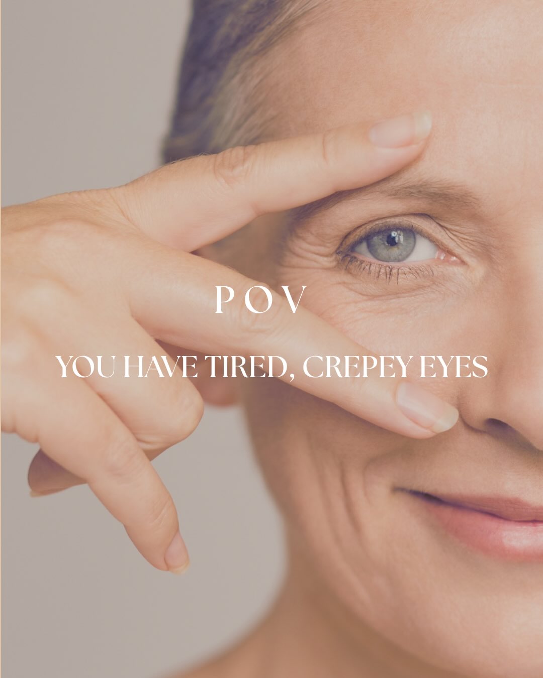 Ageing eyes? We can help!
Our Opus RF Plasma treatment + Aspect Dr Eyelift combo is designed to smooth, firm and refresh the delicate eye area targeting fine lines, texture and that tired look.
Think: collagen stimulation + deep hydration = brighter, tighter, more youthful eyes
No filters, just real results.
DM us to book or learn more about our eye treatment options. Multiple modalities available to suit your needs
#eyetreatment #crepeyeyes #opusplasma #tiredeyes #skintreatmentsbrisbane