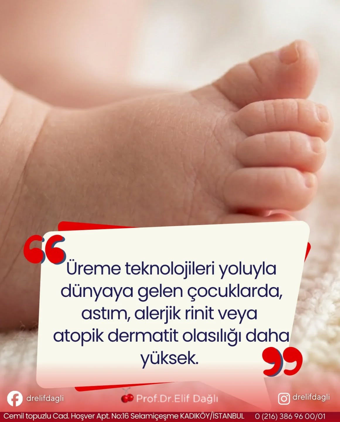 Üreme teknolojileri yoluyla dünyaya gelen çocuklarda, astım, alerjik rinit veya atopik dermatit olasılığı daha yüksek.