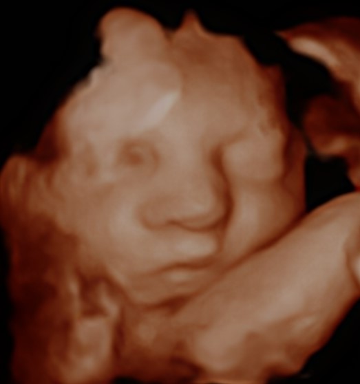 A little hello before you meet them 🤍
There’s nothing quite like seeing your baby for the first time on screen💫
Scans available from 8 weeks, gender scans from 16 weeks, and 4D scans from around 24 weeks💙
📍 BabyScanUK - Nelson & Cross Hands Scan Clinics
👉 Book your scan online
#4DUltrasound #PrivateScanClinic #PrivateUltrasound #BabyScanUK #4DScan