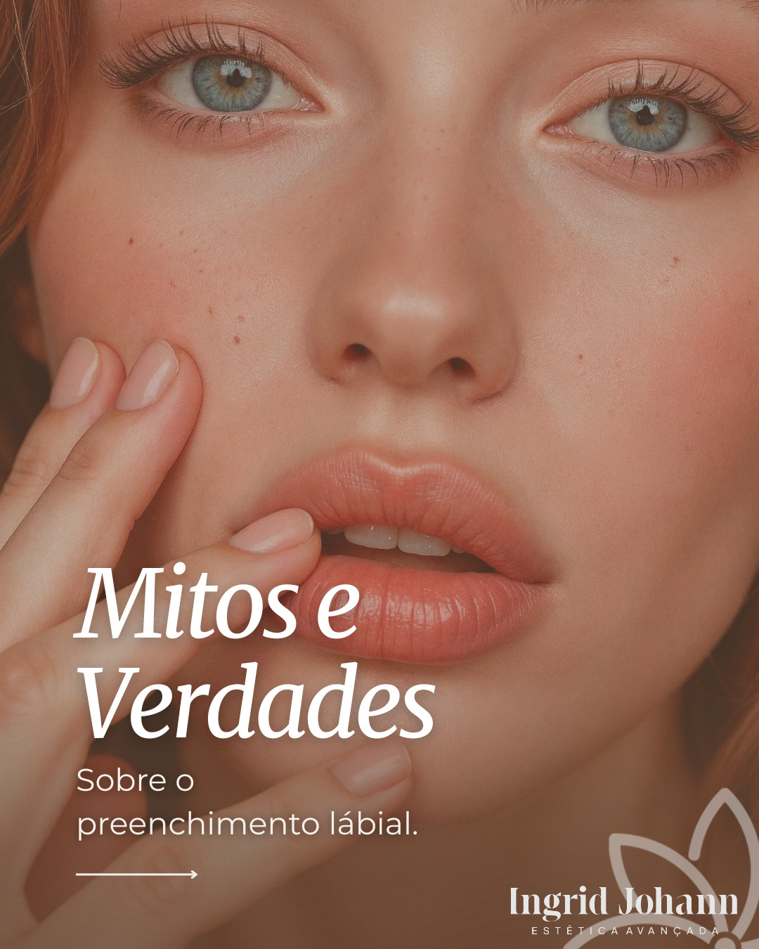 Preenchimento labial: o que é mito e o que é verdade?
Se você ainda tem receio de ficar com um resultado artificial, pode ficar tranquila… o segredo está na técnica, na quantidade e, principalmente, na naturalidade ✨
Hoje, o preenchimento labial vai muito além de volume:
- hidrata
- define o contorno
- melhora a simetria
- e realça sua beleza de forma leve
✔️ Sim, é possível ter um resultado natural — e esse é sempre o objetivo.
Cada lábio é único, e o procedimento deve respeitar isso.
📲 Agende sua avaliação e descubra o que faz mais sentido pra você!
#PreenchimentoLabial #LábiosNaturais #ÁcidoHialurônico #BelezaNatural #HarmonizaçãoFacial