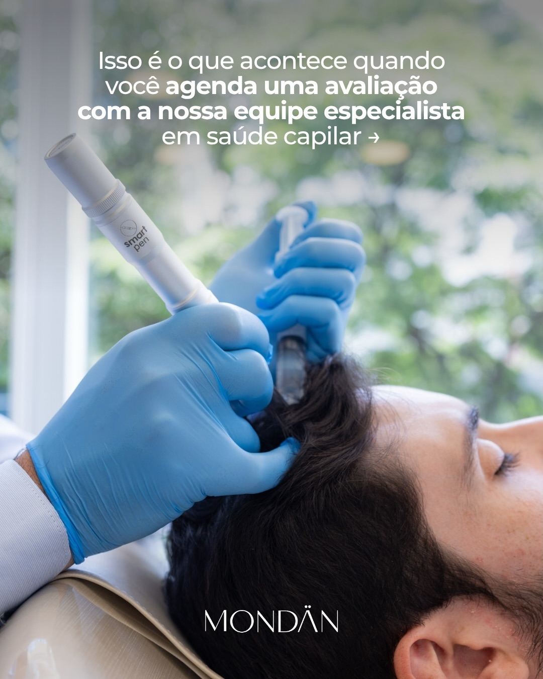 Nem toda queda capilar precisa de transplante.
Mas também nem toda queda se resolve com produtos.
O ponto central é entender o seu caso.
Em alguns pacientes, o tratamento é clínico e medicamentoso.
Em outros, o transplante capilar pode ser a melhor indicação.
Na Mondän, o cuidado começa com uma análise detalhada do couro cabeludo e um diagnóstico preciso, para que o tratamento seja direcionado ao que você realmente precisa.
Se você já percebe queda, falhas ou afinamento dos fios, agende sua avaliação e entenda qual é o melhor caminho para o seu caso.