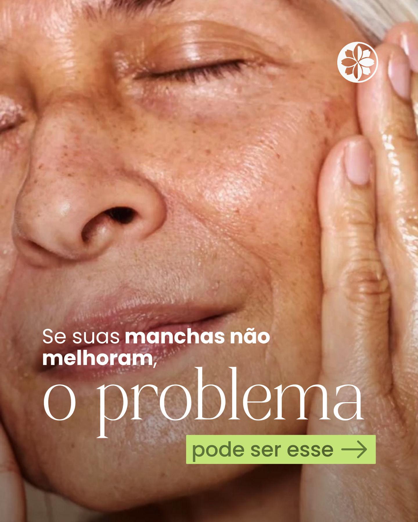 Se as manchas não melhoram, provavelmente o problema não está na sua pele, está na forma como você está tratando.
Manchas podem ter diferentes causas, como exposição solar, inflamação e alterações hormonais. Por isso, um cuidado isolado dificilmente traz resultado consistente.
O Protocolo Pele sem Manchas BelClinic combina ativos que ajudam a uniformizar o tom da pele, melhorar o aspecto de manchas e devolver a luminosidade.
🍂 E o outono é o momento ideal para iniciar esse cuidado, já que a pele responde melhor aos tratamentos.
Você ganha o Illumina para potencializar seus resultados
na compra do protocolo (DermaBlanc N + Vitamina C),
ou 20% OFF na compra do Mousse Chá-verde + DermaBlanc N + Vitamina C.
💚 Comece no momento certo. Acesse o link da bio para saber mais.