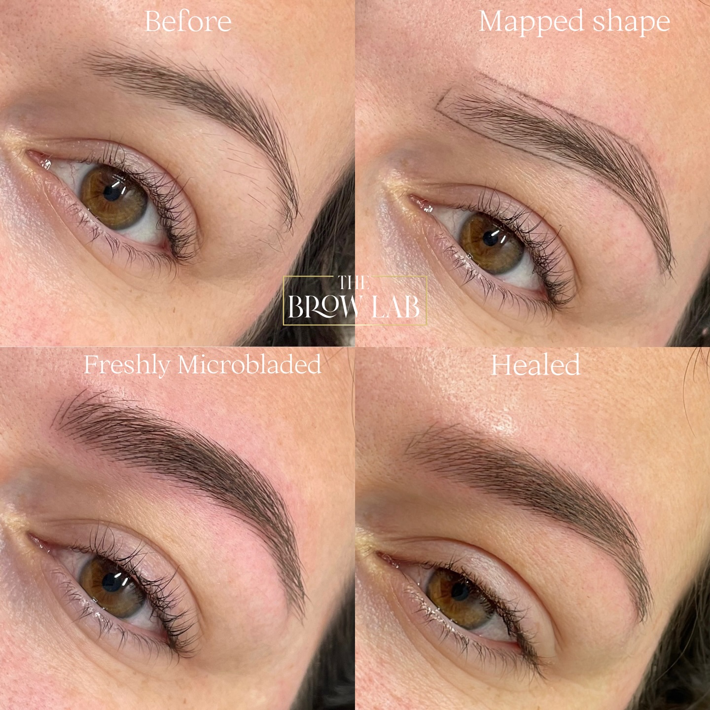 High-end microblading, done right 🤍
Every set of brows is mapped with precision, fully bespoke to your natural features and bone structure.
Freshly done brows can appear slightly darker and more defined as the pigment is newly implanted.
Once healed, they soften beautifully into a subtle, natural finish that blends seamlessly with your own hairs ✨
#healedmicroblading #hairstrokesbrows #browgoals