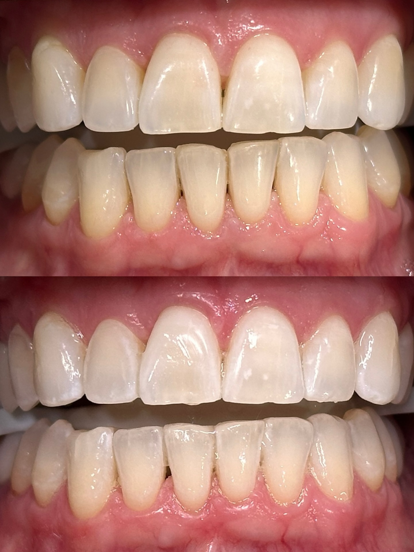 When your aura glows, nothing can dim or replicate you 🤍✨
#teethwhiteningchicago #napervilleil #chicagobeauty #napervillebeauty #whiteaura