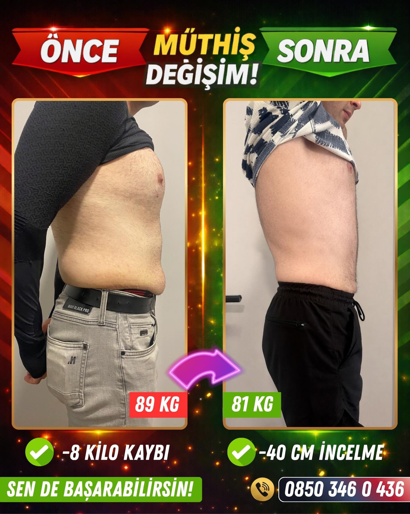 🔥 DEĞİŞİME HAZIR MISINIZ? ✅
ZAYIFLAMA PAKETİMİZ İLE KİLO VERİYORSUNUZ, İNCELİYORSUNUZ AYRICA VÜCUDUNUZ ŞEKİLLENİYOR ‼️
DANIŞANIMIZ İLE BAŞLADIĞIMIZ ZAYIFLAMA SÜRECİNDE 8 KİLO VERDİK VE 40 CM İNCELDİK 👍🏻
SPOR YAPMADAN, EFOR SARF ETMEDEN, YORULMADAN SEN DE KİLO VERMEK VE VÜCUT ŞEKİLLENDİRMEK İSTİYORSAN BİZİMLE İLETİŞİME GEÇEBİLİRSİN!
İletişim: 0850 346 0 436