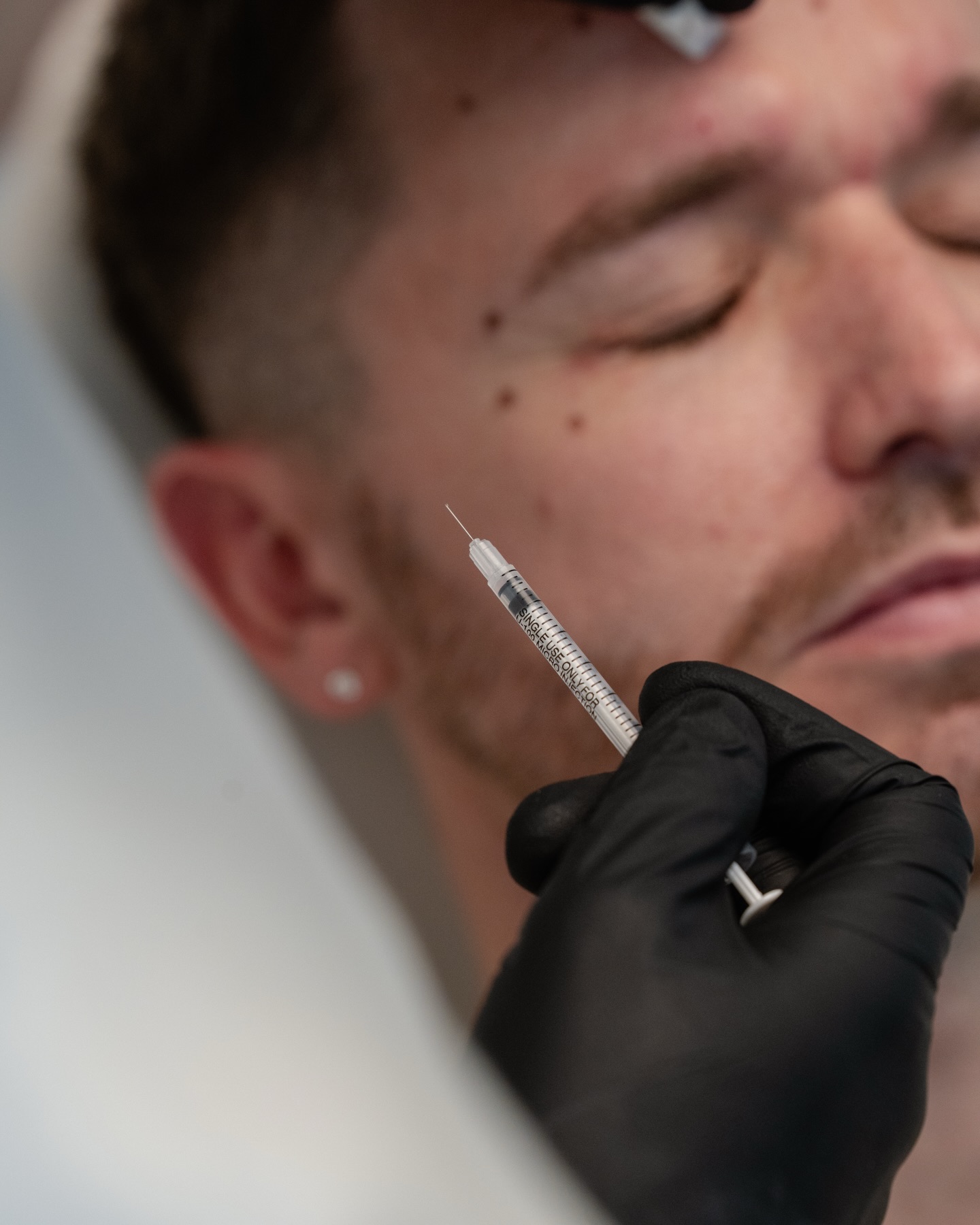 For individuals looking to reduce the appearance of fine lines and wrinkles, BTX provides a non-invasive alternative to more aggressive procedures like facelifts. BTX works by temporarily relaxing the muscles beneath the skin, which smooths out wrinkles caused by facial expressions, such as crow’s feet and frown lines.
BOOK YOUR CONSULTATION 🙏🏻
•
•
Für Menschen, die feine Linien und Falten reduzieren möchten, bietet BTX eine nicht-invasive Alternative zu invasiveren Eingriffen wie Facelifts. BTX wirkt, indem es die Muskeln unter der Haut vorübergehend entspannt, wodurch durch Mimik verursachte Falten wie Krähenfüße und Zornesfalten geglättet werden.
BUCHEN SIE IHR BERATUNGSGESPRÄCH
https://www.dermedesthetic.ch