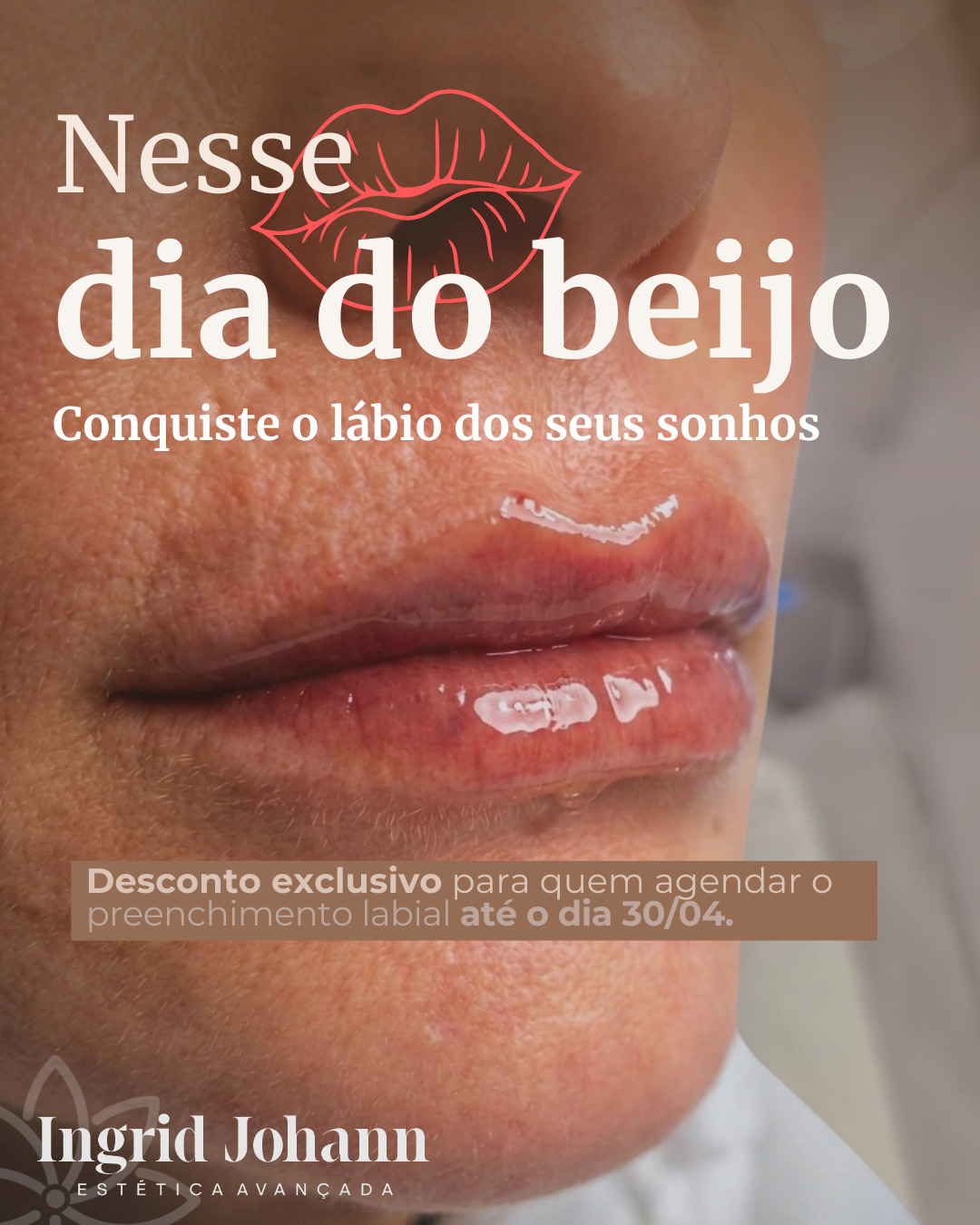 💋 Neste Dia do Beijo, que tal se apaixonar ainda mais pelo seu sorriso?
Lábios mais hidratados, definidos e com aquele volume natural que valoriza toda a sua beleza ✨
E o melhor… tem condição especial pra você aproveitar 👇
🎁 Desconto exclusivo para quem agendar seu preenchimento labial até 30/04
💖 Porque se sentir linda também é um gesto de amor próprio.
📲 Garanta seu horário e conquiste os lábios dos seus sonhos!
#DiaDoBeijo #PreenchimentoLabial #LábiosPerfeitos #ÁcidoHialurônico #Autocuidado