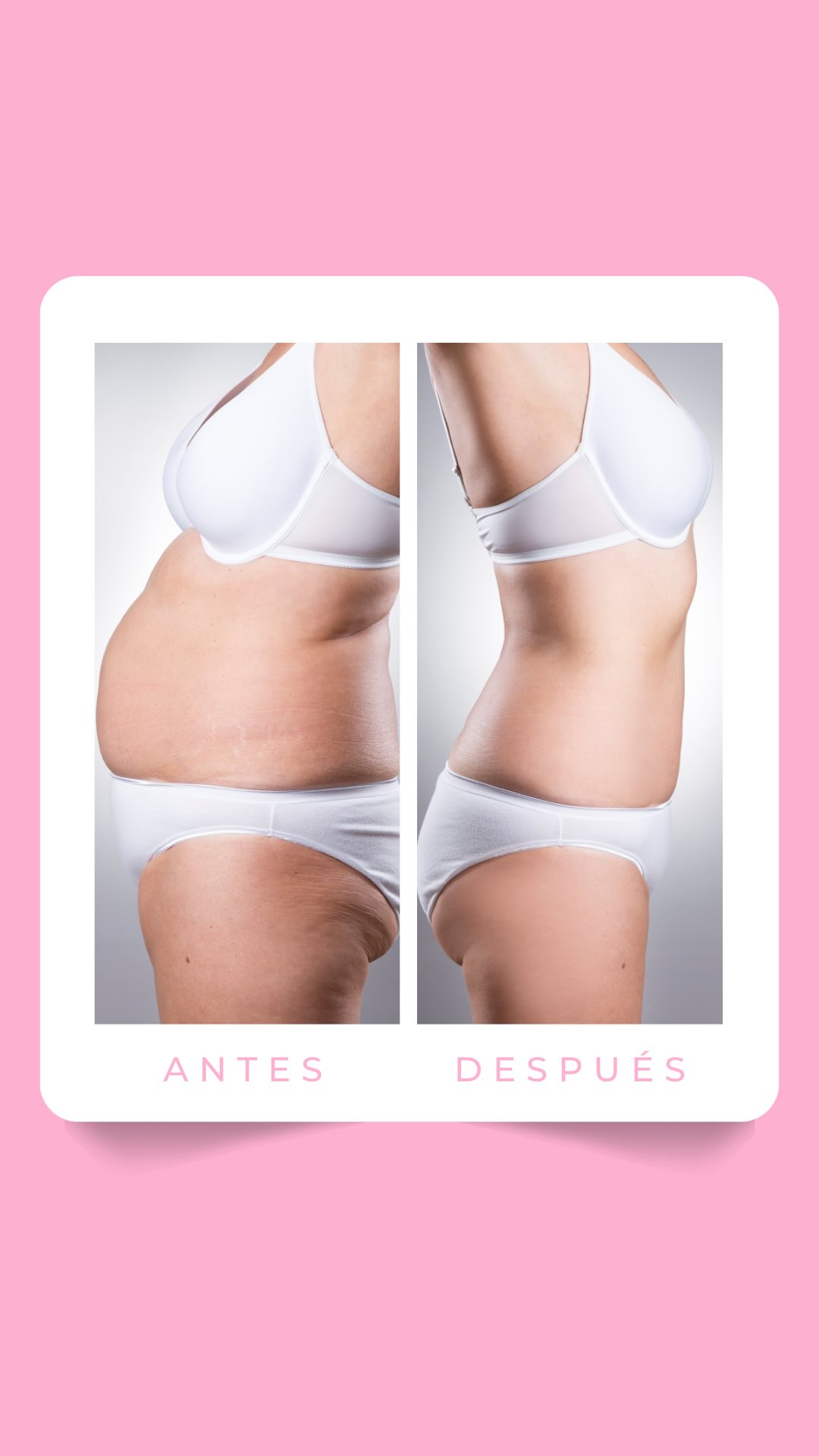 ¿Quieres llegar a verano sintiéndote mejor?
Si quieres remodelar tu cuerpo, escríbenos, agendamos tu valoración GRATUITA y nos ponemos manos a la obra.
¡Sí es posible!💗