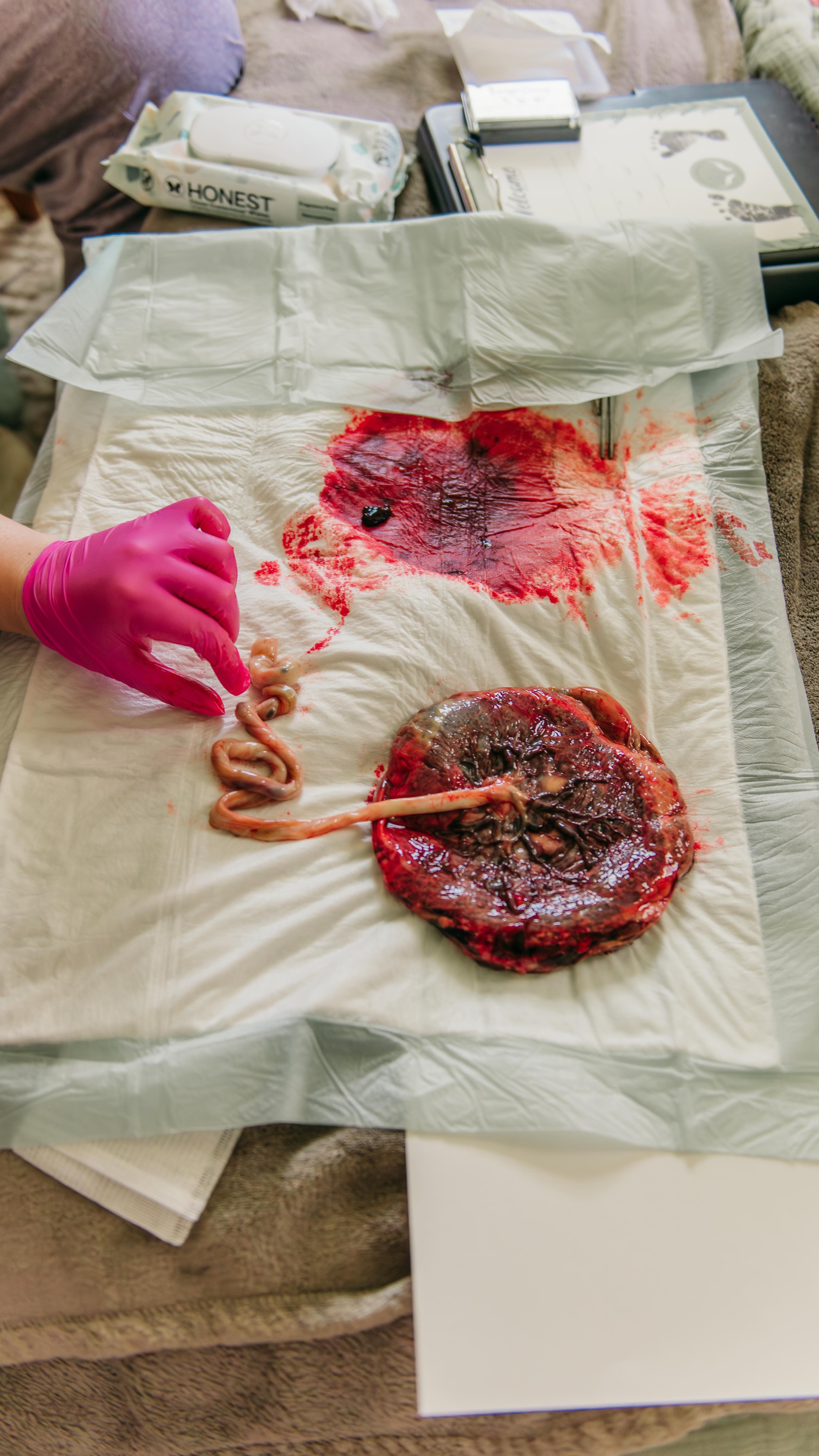 Imagine how disconnected we’ve had to become to not trust this….nothing about this is random!
The placenta is the only organ your body grows from scratch—formed in partnership between mother and baby, sustaining life for months without a single conscious thought. It oxygenates, nourishes, filters, protects, and then… when its work is complete, it is released.
Every part of pregnancy, birth, and postpartum reflects a level of intelligence that deserves to be seen, understood, and honored—not feared.
As a doula, witnessing this again and again is what keeps me so deeply rooted in this work. Because it all fits. The rhythms, the timing, the connection between mother and baby—it’s not chaotic, it’s intentional.
This is why we honor the placenta.
Not out of trend or ritual alone, but out of respect for the role it played in sustaining life.
What’s something about birth or your body that made you pause in awe? ✨