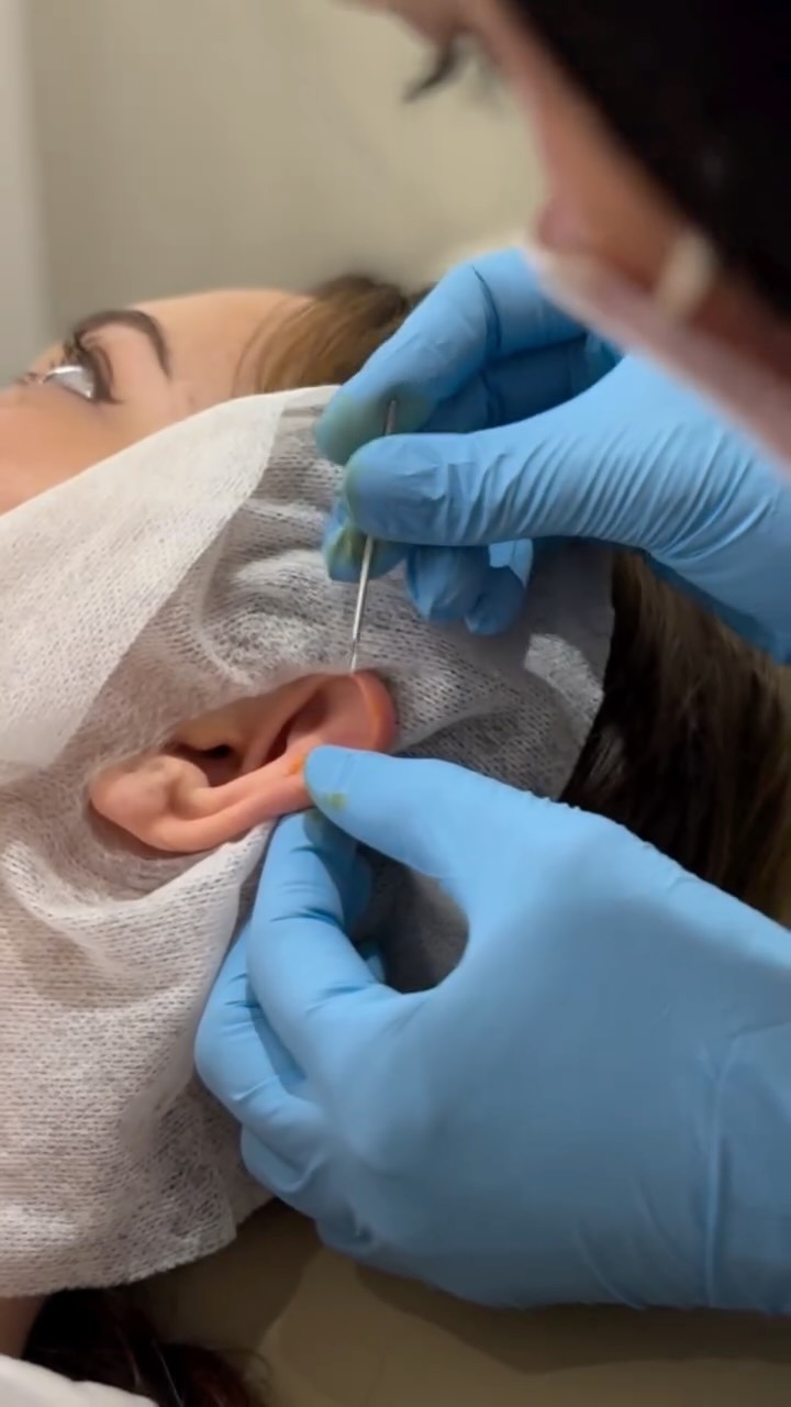 Come along with @sofipierces ✨
Our regular guest piercer at Auryn ~ keep an eye on our diary to see when she’s next here and book in!
Pierced with classic, implant grade titanium.