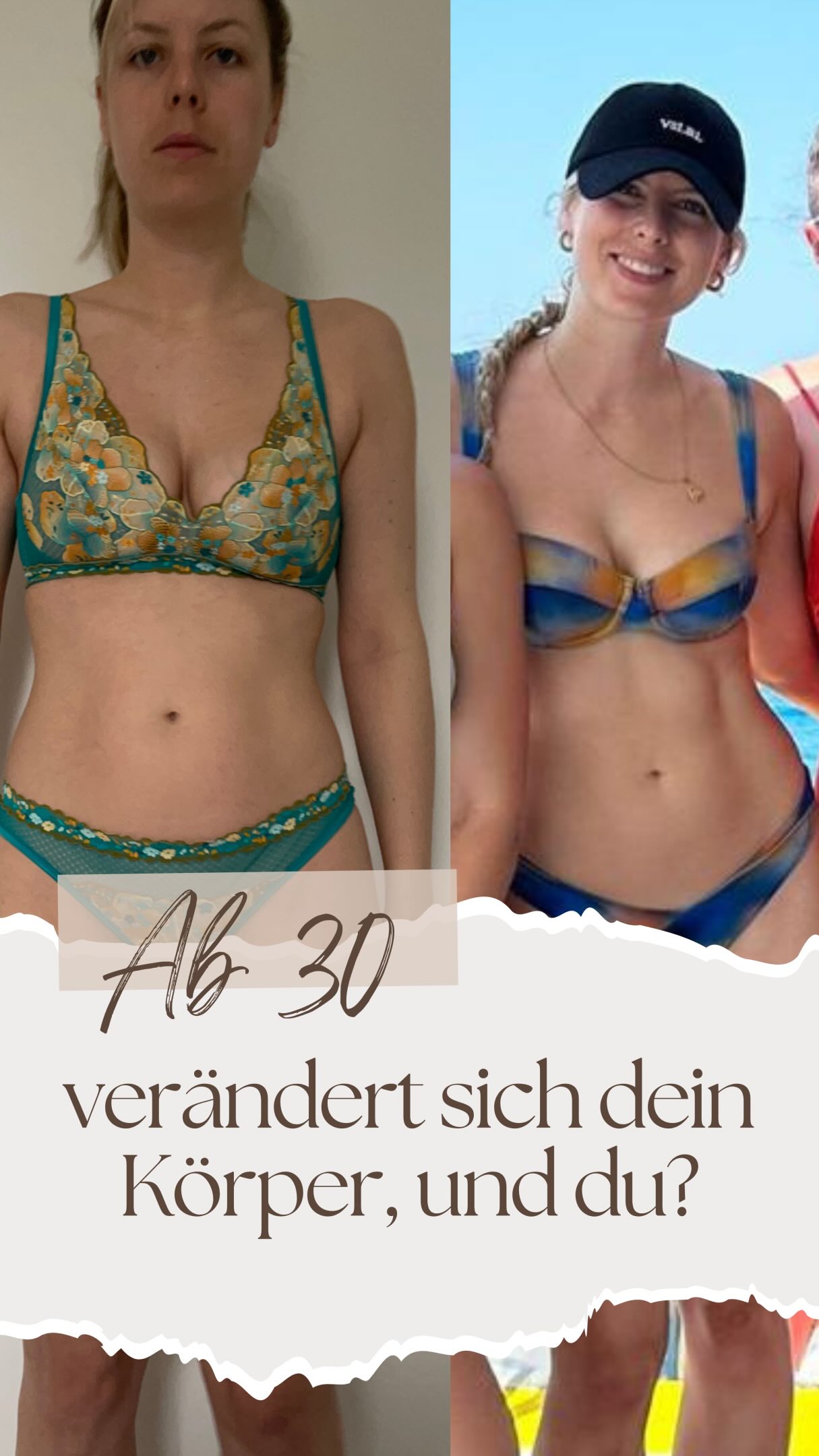 Vielleicht kennst du diese kleinen „Wehwehchen“…
Blähbauch.�Unverträglichkeiten.�Müdigkeit.�Hautprobleme.
Und irgendwo dieses Gefühl:�👉 „Irgendwie altere ich schneller, als ich eigentlich möchte…“
Und das Verrückte ist:�Wenn man sich umschaut, scheint es fast normal zu sein.
„Das gehört halt dazu.“�„Andere haben das auch.“�„Wird wohl Stress sein…“
Aber ganz ehrlich?�Es hat sich für mich nie richtig angefühlt.
Ich habe so viel ausprobiert.�Ernährungsformen.�Behandlungen.�Untersuchungen.
Und trotzdem:�keine nachhaltige Veränderung.
Bis ich angefangen habe, meinen Körper wirklich zu verstehen.
Und plötzlich wurde mir klar:
👉 Es lag nicht daran, dass ich „nicht gesund genug“ gelebt habe.�👉 Sondern daran, dass meine Ernährung nicht zu meinem Stoffwechsel gepasst hat.
Mein System war dauerhaft im Stress.�Unterversorgt.�Überfordert.
Und genau das hat sich verändert.
Heute:�✨ keine Unverträglichkeiten mehr�✨ kein täglicher Blähbauch�✨ mehr Energie�✨ mehr Klarheit�✨ biologisches Alter: –3 Jahre in 6 Monaten
Und das Wichtigste:�Ich habe das Gefühl, meinen Körper endlich zu verstehen.
Heute stelle ich mir nicht mehr die Frage:�Was ist gesund?
Sondern:�👉 Was passt zu meinem Körper?
Denn Altern passiert.�Aber wie schnell, das können wir beeinflussen.
Wenn du verstehen möchtest,�was dein Körper wirklich braucht,
kommentiere INFO 🤍
💌 Dann sende ich dir deine persönliche Einladung�zu meiner kostenfreien Live-Info-Stunde.
Dort zeige ich dir ganz transparent:�🧬 warum Ernährung nicht für jeden gleich funktioniert�✨ wie du deinen Stoffwechsel wirklich verstehst�💛 und wie du deinen Körper langfristig unterstützt
Ich habe mittlerweile über 200 Frauen begleitet�und gebe dir ehrliche Einblicke, die du sofort für dich nutzen kannst.
#theinneryouth #slowaging #stoffwechselaktivierung