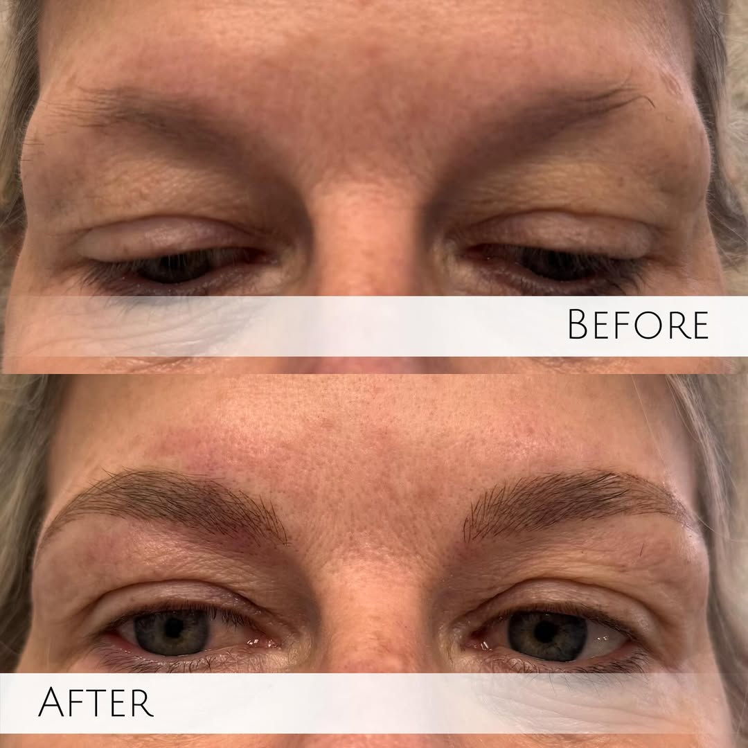 Megan’s microblading work is all about creating brows that look like your brows — just fuller, more balanced, and beautifully defined. Using ultra-fine, hair-like strokes, she customizes every detail for natural-looking results that fit your face.
✔ Custom brow shaping
✔ Pigment matched to your skin tone + hair color
✔ Soft, realistic finish
Fresh brows are shown here — expect the color to lighten and soften beautifully during the healing process. 🤍
#MicrobladingResults #BrowArtist #BrowGoals #TighterLinesAesthetics #JupiterFlorida